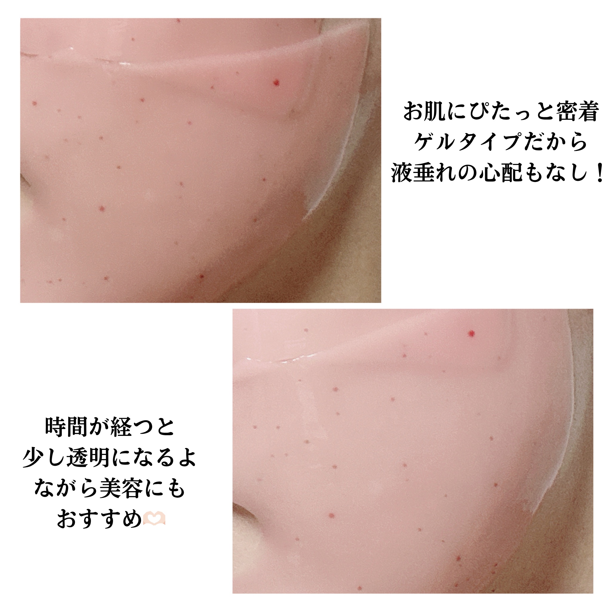 アゼライン-センテラ スキンマグネットマスク/Dr.nineteen/シートマスク・パックを使ったクチコミ（3枚目）