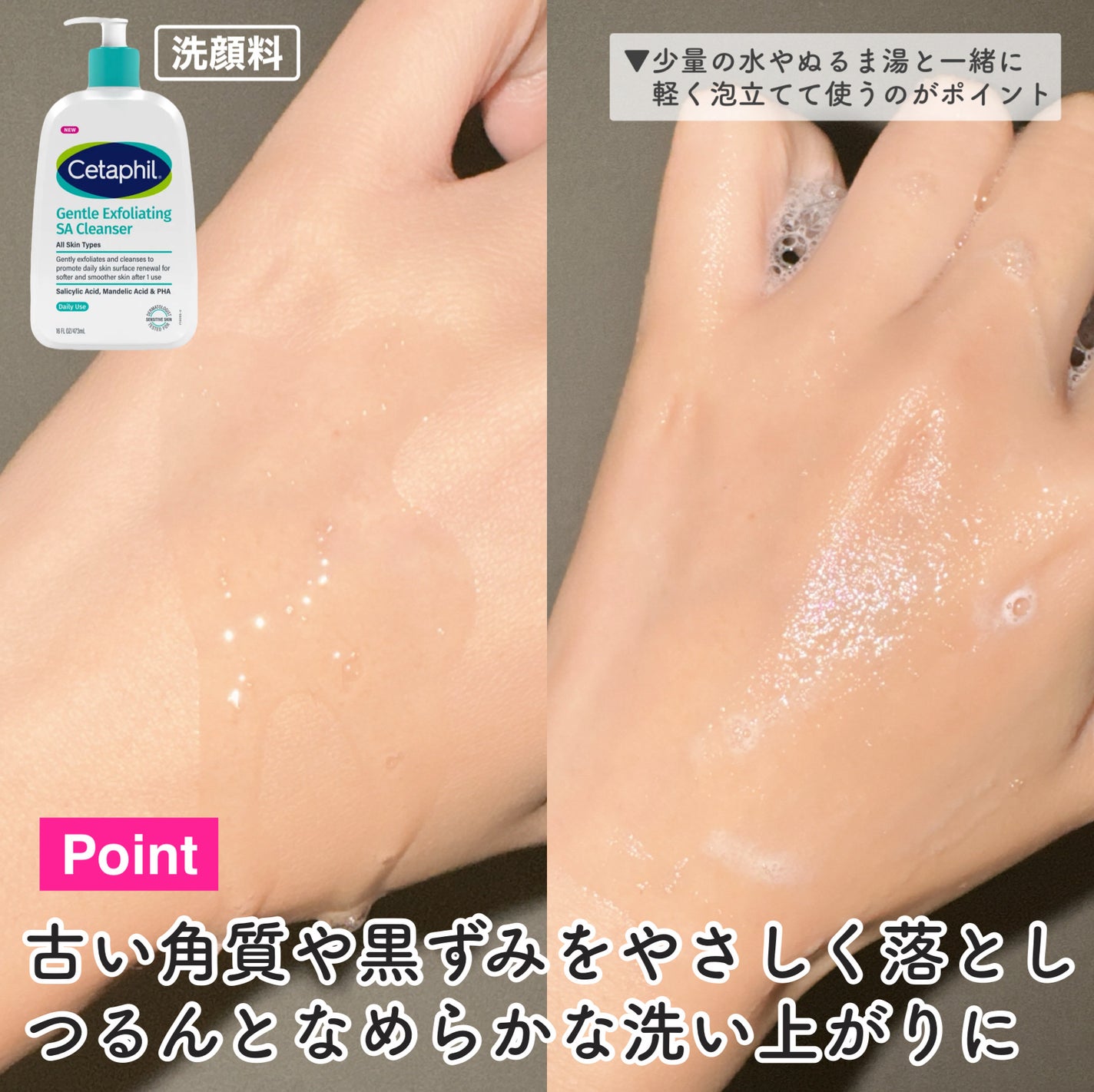 セタフィル ジェントルSAクレンザー/セタフィル/ピーリングを使ったクチコミ(4枚目)