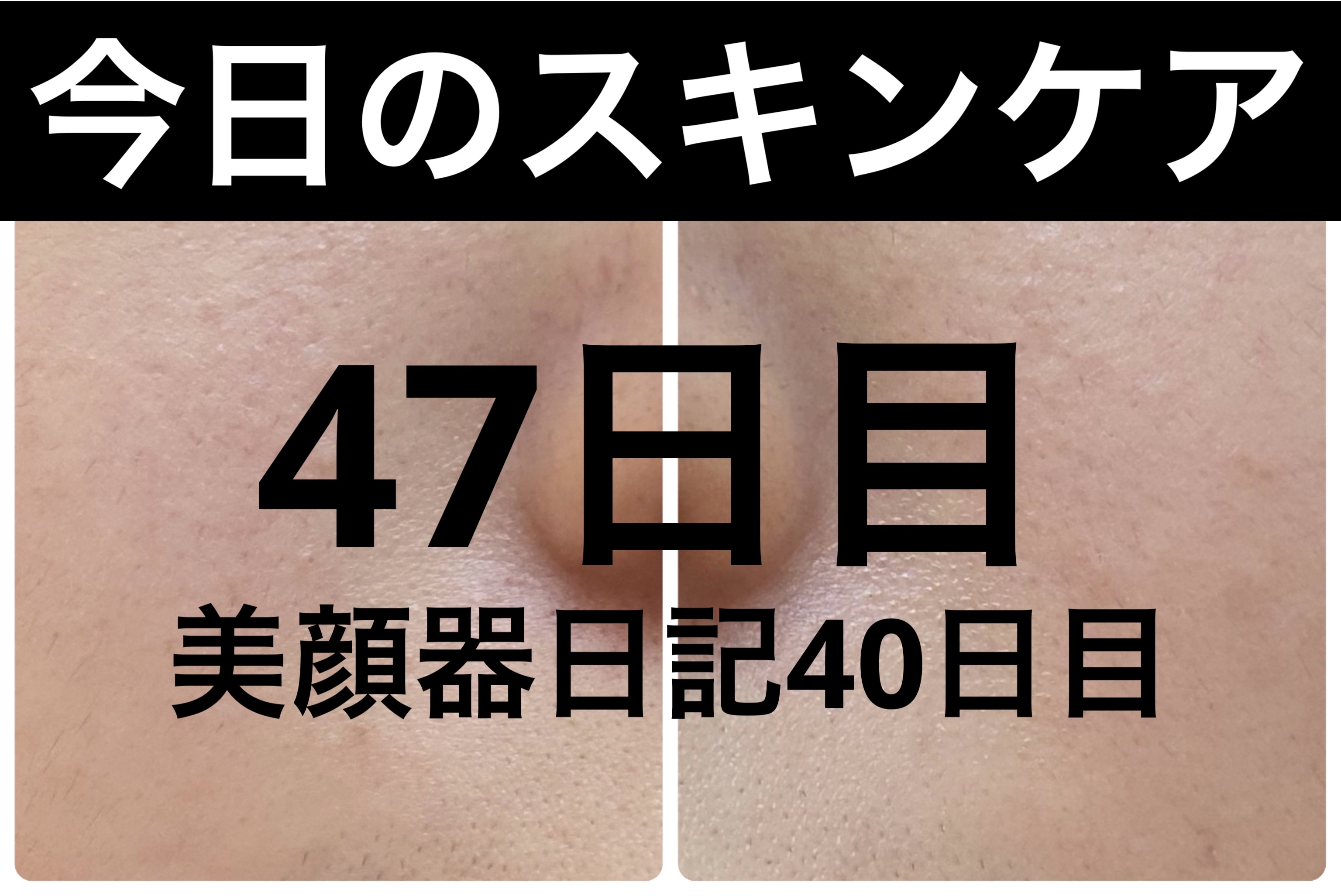 薬用雪肌精 ブライトニング クレンジング オイル[医薬部外品]/雪肌精/オイルクレンジングを使ったクチコミ（1枚目）