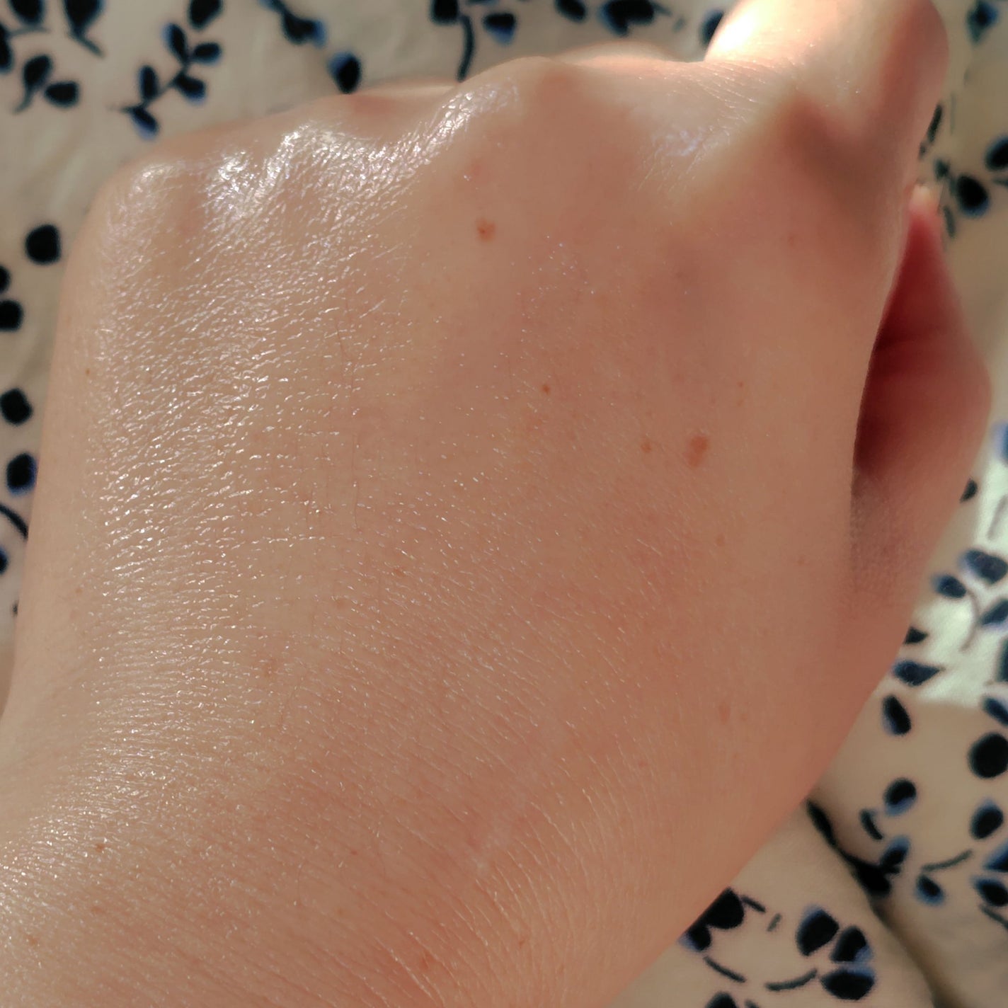 セルフホワイトニング ミッション/ALBION/美容液を使ったクチコミ(5枚目)