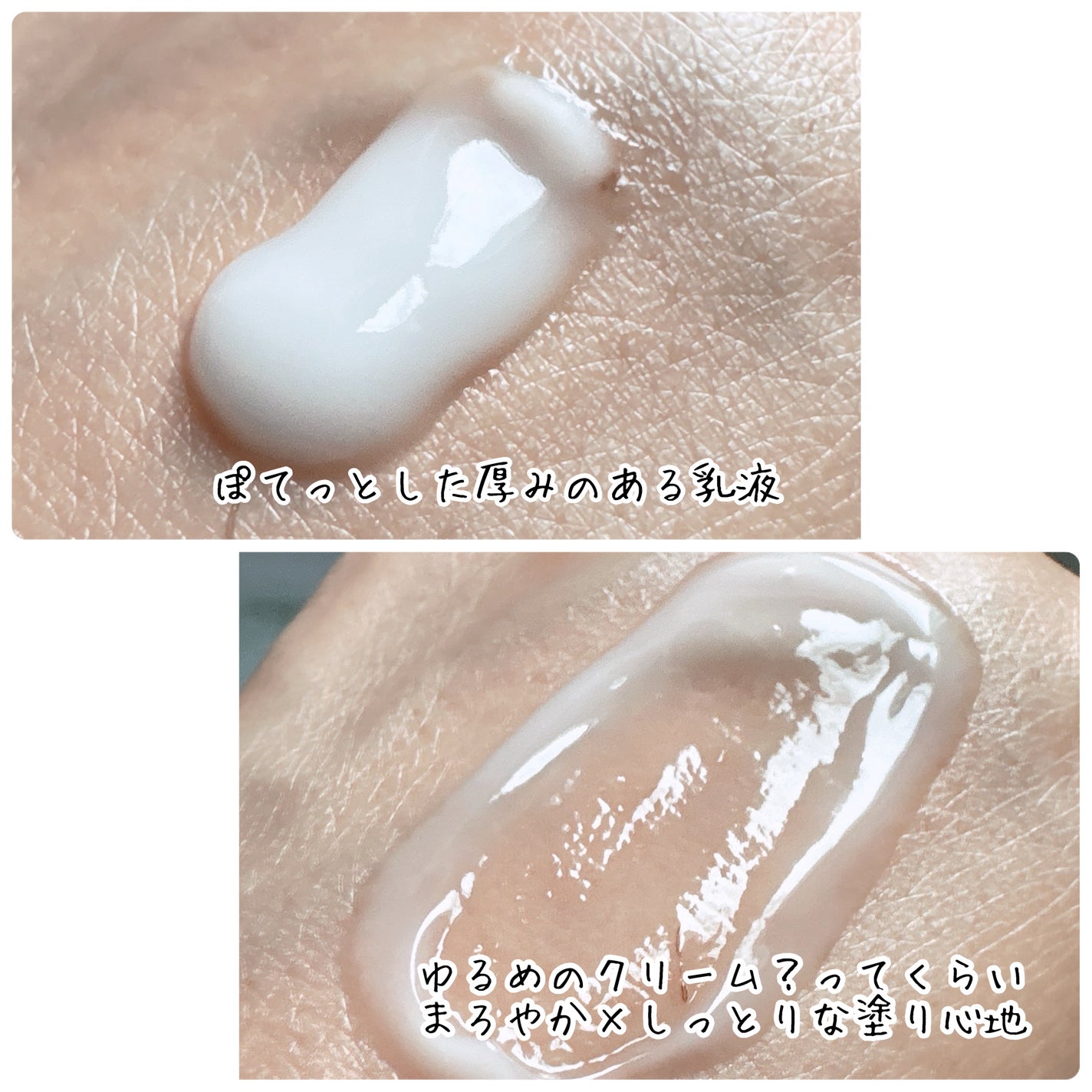 トイロ バランシングドロップ<医薬部外品>(化粧液)/ファンケル/化粧水を使ったクチコミ(5枚目)