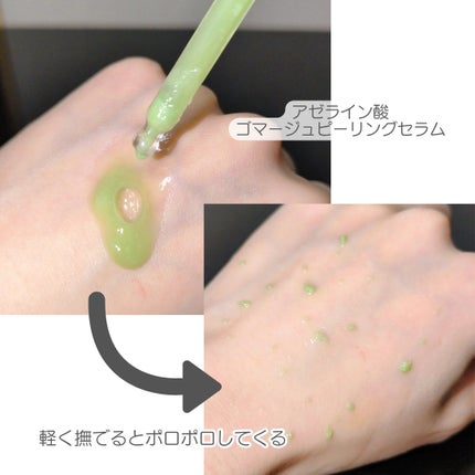 アゼライン酸ゴマージュピーリングセラム/Dr.Melaxin/美容液を使ったクチコミ(2枚目)