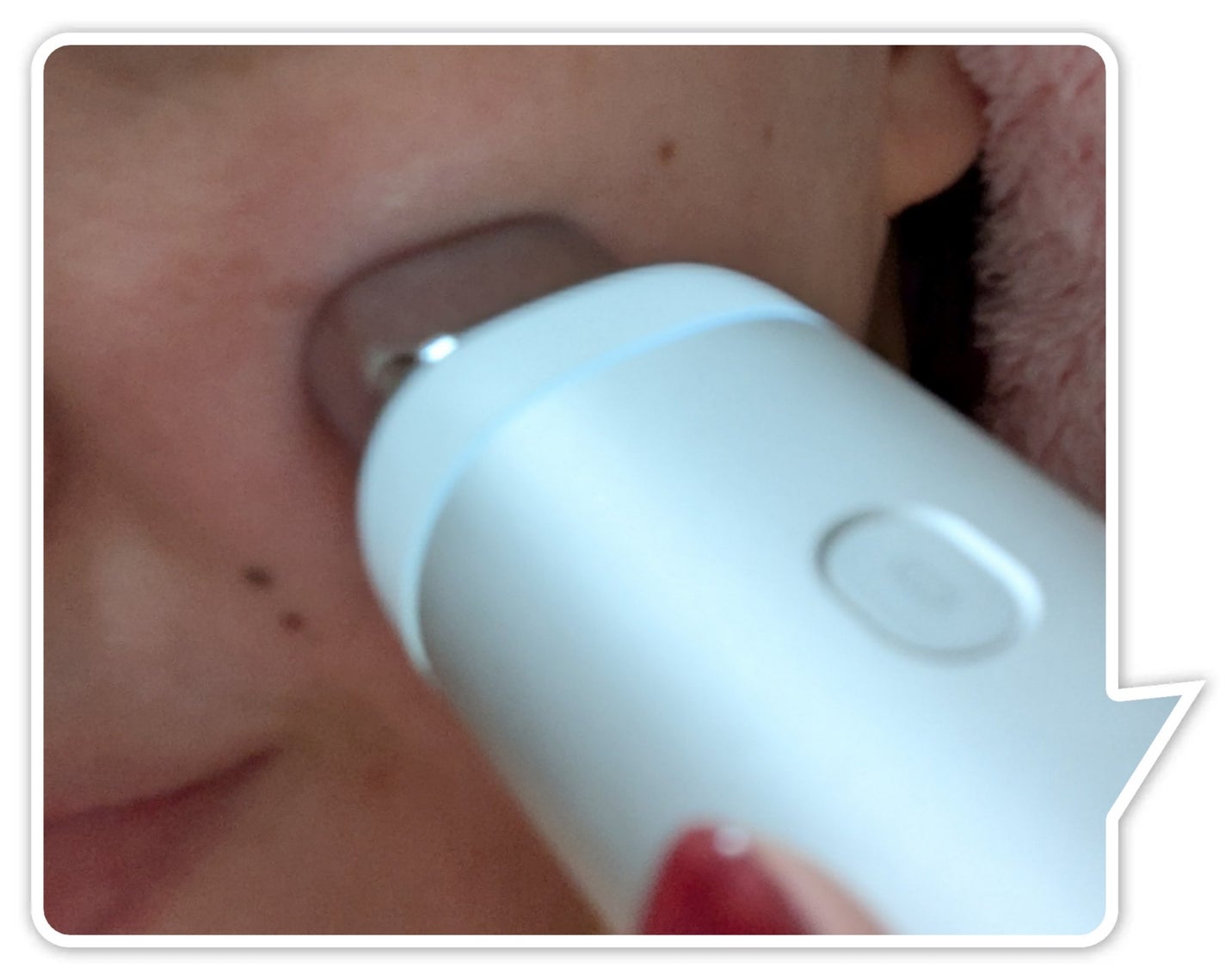 スキンスキャナー/BELLATECH/その他スキンケアグッズを使ったクチコミ(3枚目)