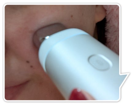 スキンスキャナー/BELLATECH/その他スキンケアグッズを使ったクチコミ(3枚目)