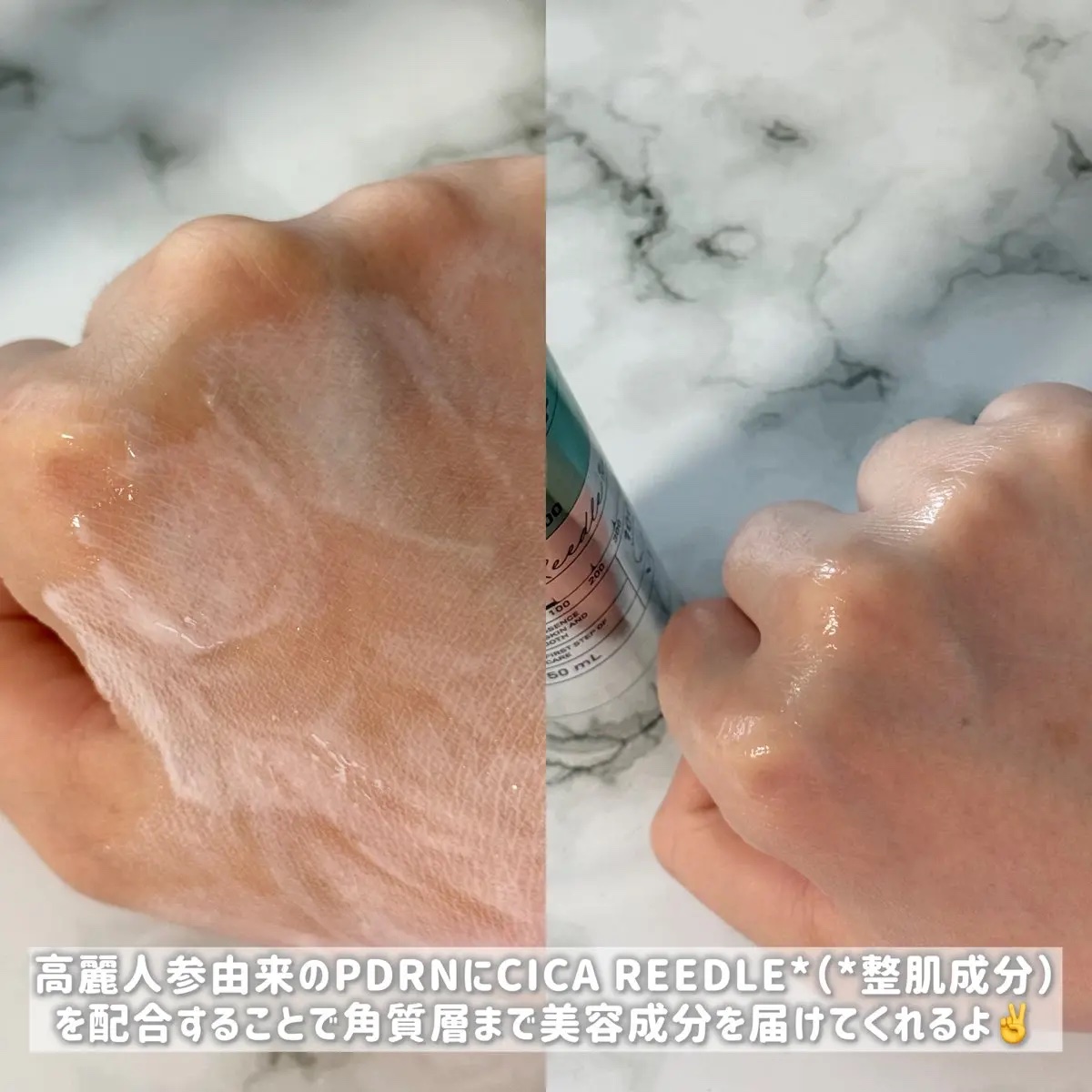 PDRN+リードルS 100/VT/美容液を使ったクチコミ（3枚目）