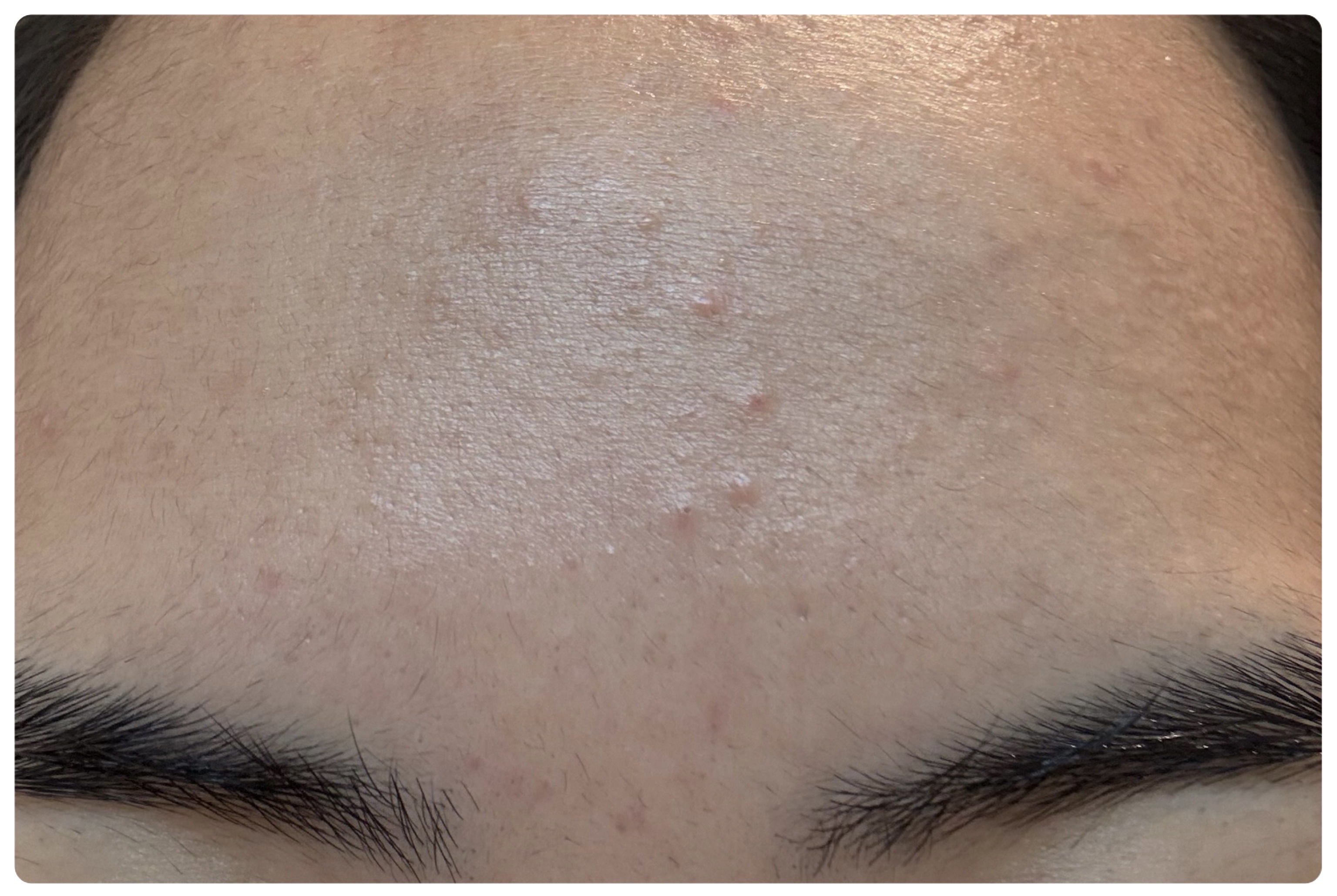 薬用雪肌精 ブライトニング クレンジング オイル[医薬部外品]/雪肌精/オイルクレンジングを使ったクチコミ（3枚目）