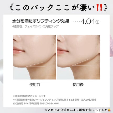 Arocell ラッピングマスク/AROCELL/その他スキンケアを使ったクチコミ(6枚目)