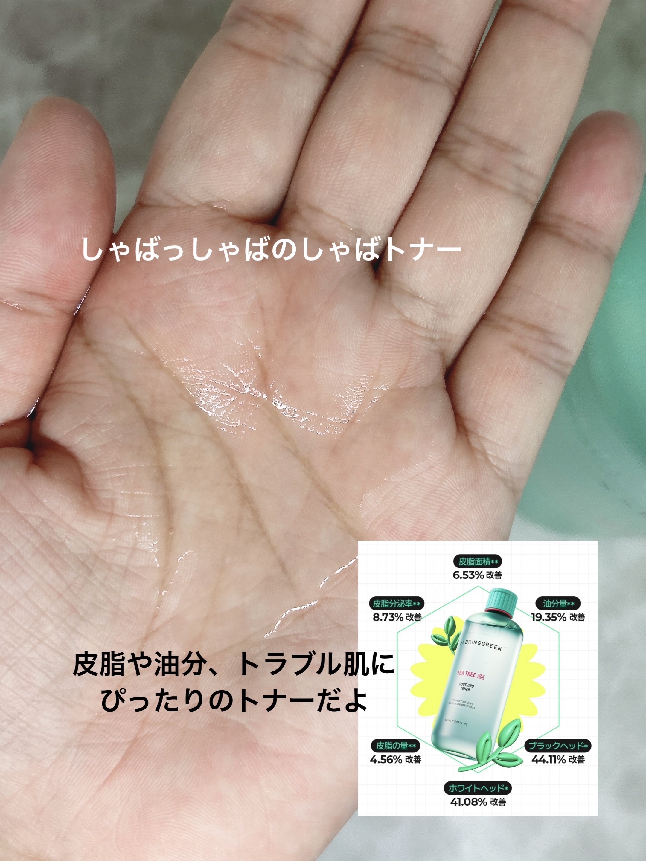 ティーツリーシカスージングトナー/BRING GREEN/化粧水を使ったクチコミ（2枚目）