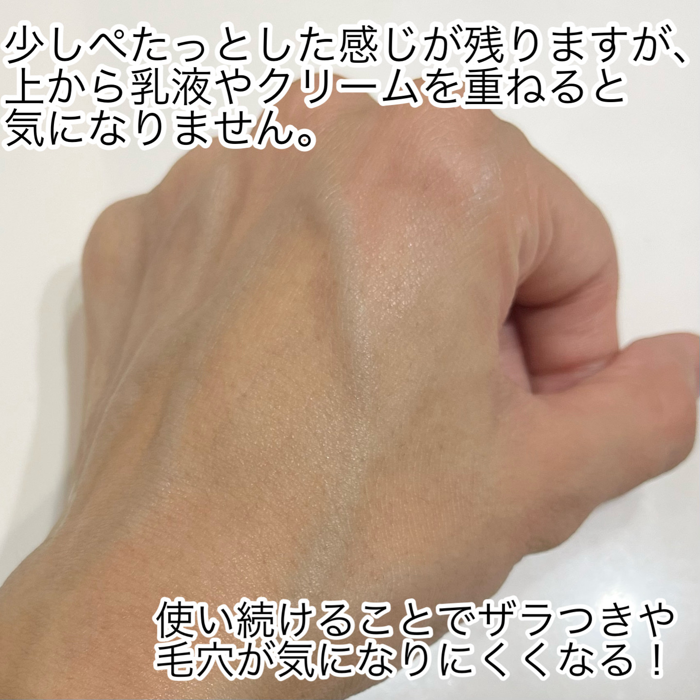 エファクラ ピールケア セラム/ラ ロッシュ ポゼ/美容液を使ったクチコミ（3枚目）