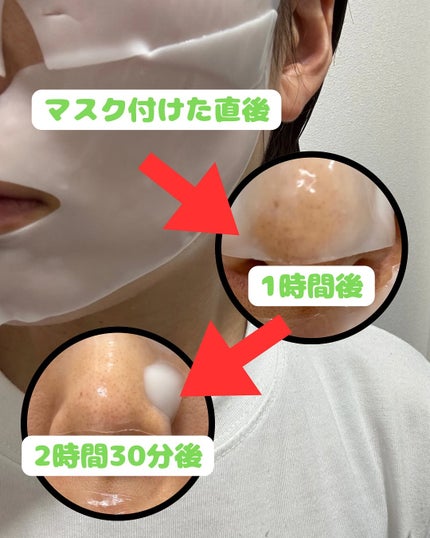 KC SKIN モイストリペアセラムマスク/KC SKIN – Kristen Claire/シートマスク・パックを使ったクチコミ(5枚目)