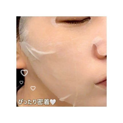 クリアターン アゼライン酸BOMBマスク/クリアターン/シートマスク・パックを使ったクチコミ(6枚目)