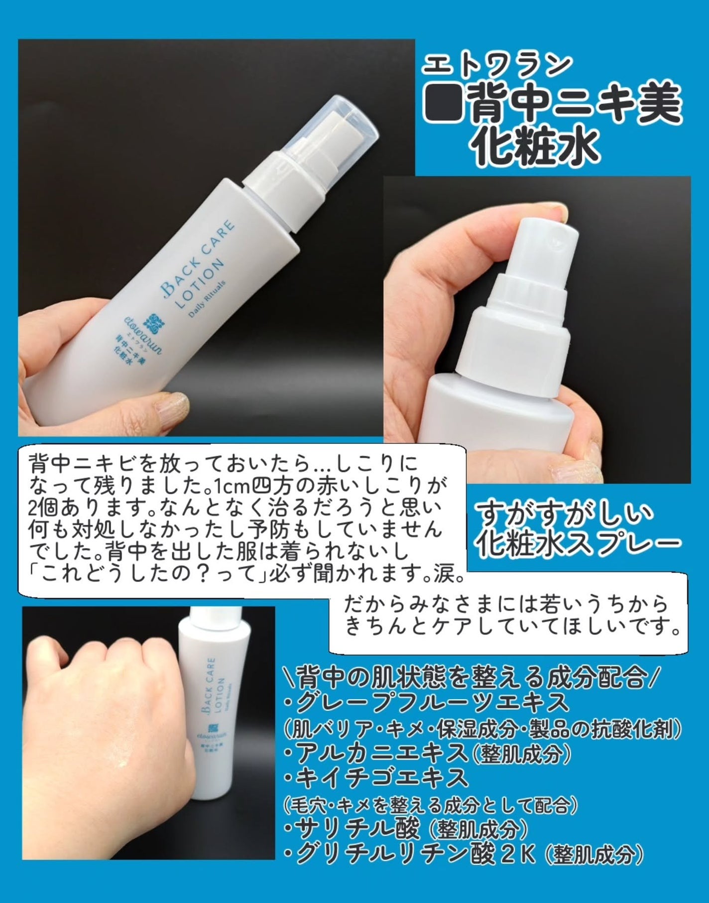 背中ニキ美 化粧水/エトワラン/ボディローションを使ったクチコミ(2枚目)