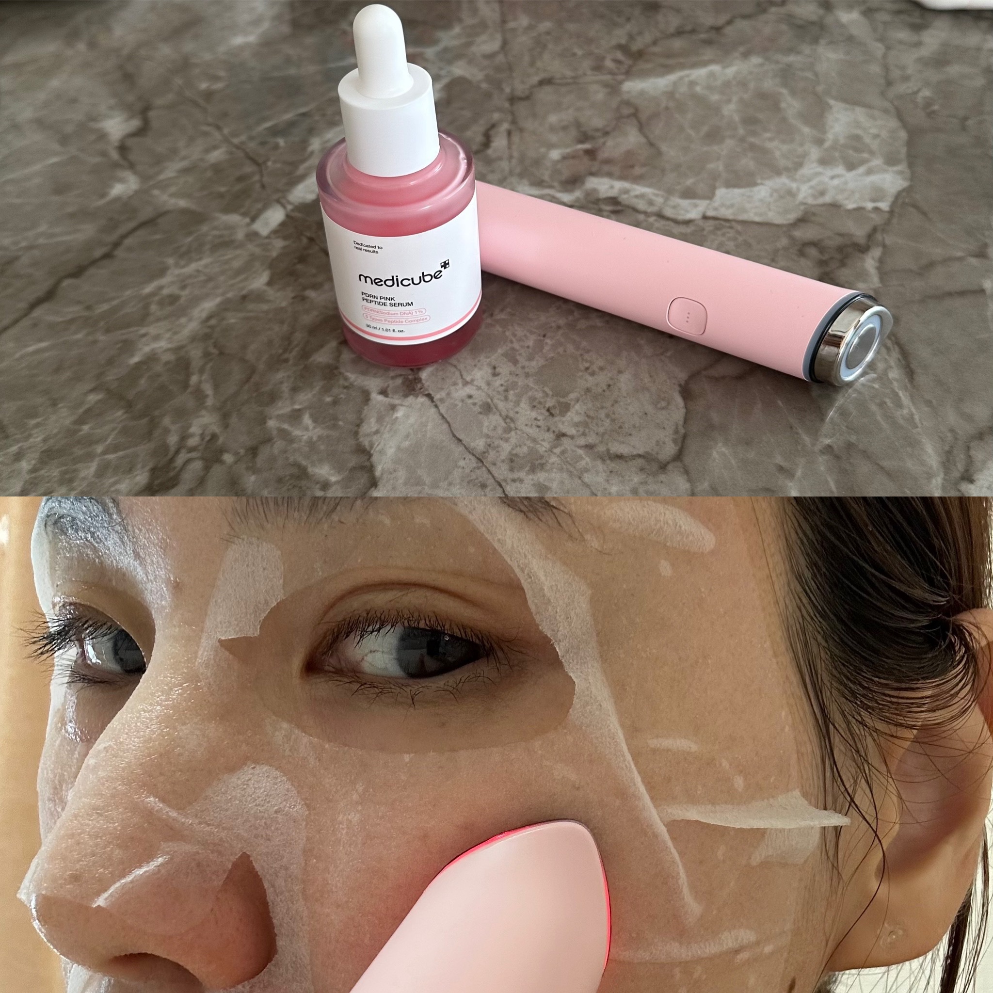 AGE-R ブースタープロ ピンク（ミニ）/MEDICUBE/美顔器・マッサージを使ったクチコミ（1枚目）