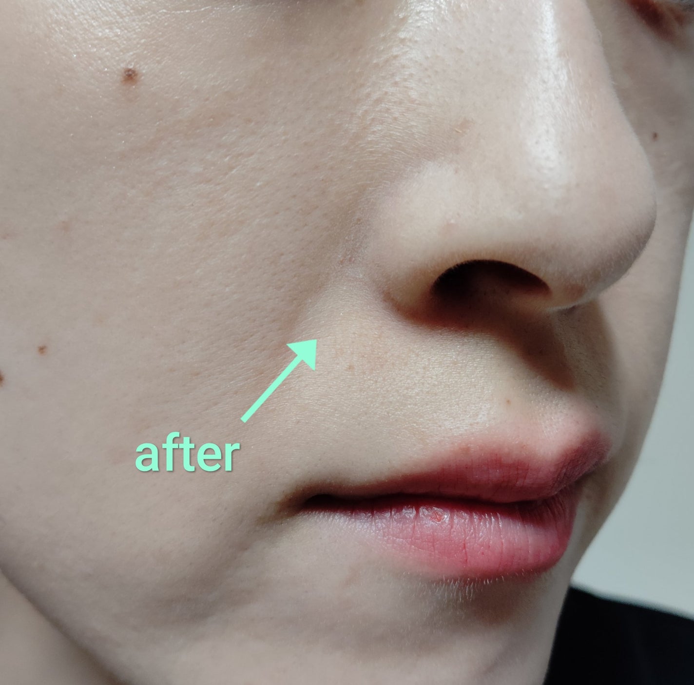 プレストパウダー C/ポイントマジックPRO/プレストパウダーを使ったクチコミ(6枚目)