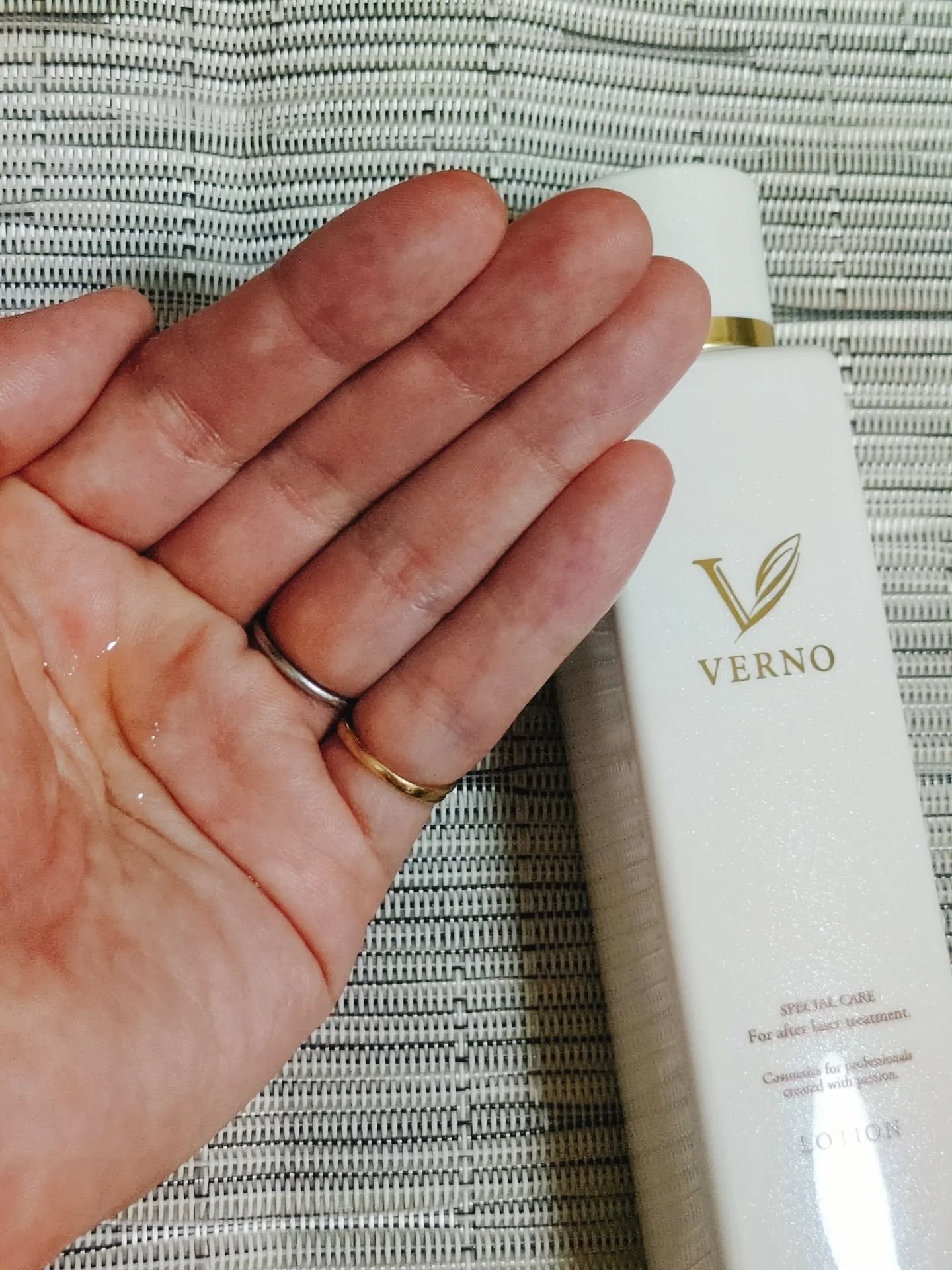 VERNO SKIN ローション〈医薬部外品〉/VERNO SKIN CARE/化粧水を使ったクチコミ（2枚目）