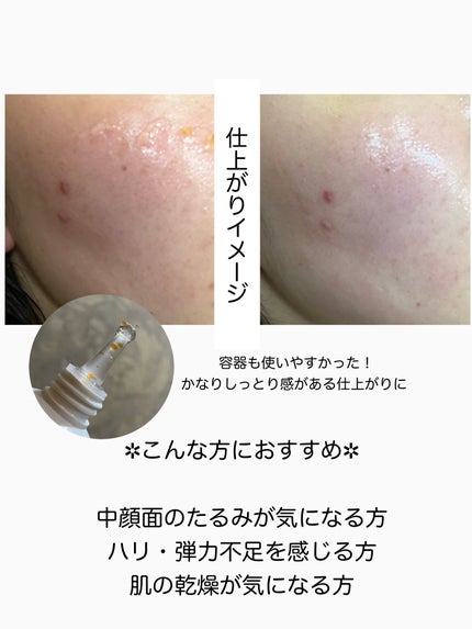 PDRNキューブクリーム/DPPR/フェイスクリームを使ったクチコミ(4枚目)