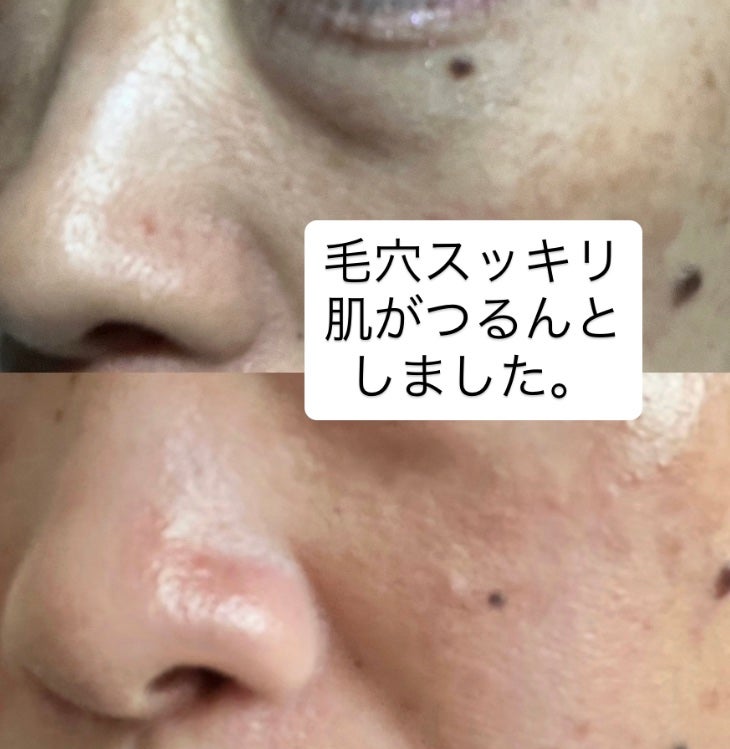 ストレッチ&グロウ ブラックソルトクレンジングパウダー/EveryRoutine/洗顔パウダーを使ったクチコミ(8枚目)