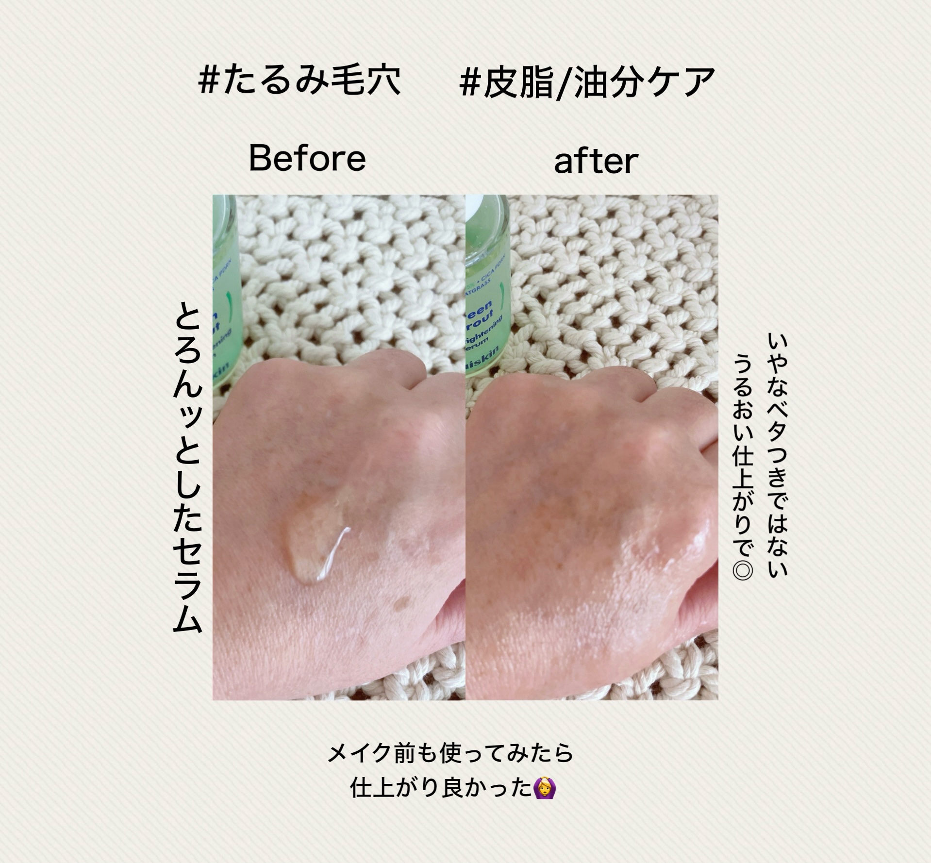 若芽ポアタイトニングセラム/suiskin/美容液を使ったクチコミ（3枚目）