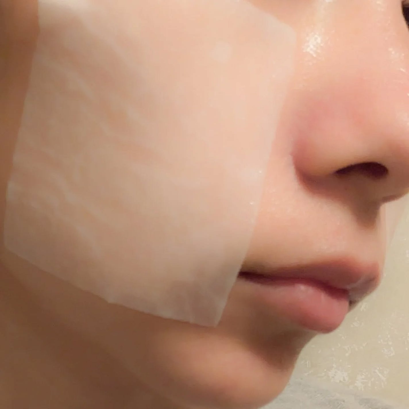 リズム ピコレーザー ニードルスポットパック/RISM/シートマスク・パックを使ったクチコミ(5枚目)