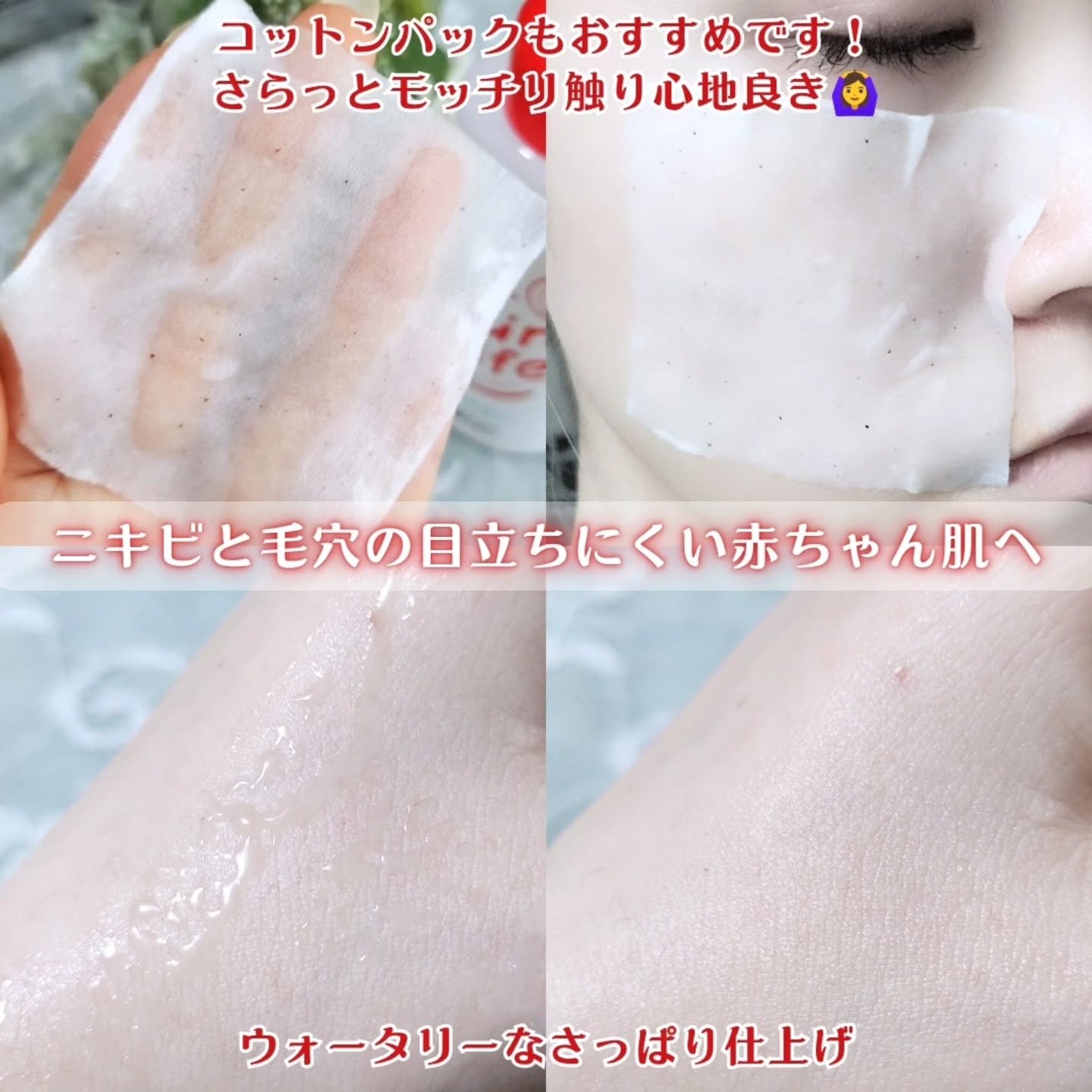薬用化粧水/スキンライフ/化粧水を使ったクチコミ(4枚目)