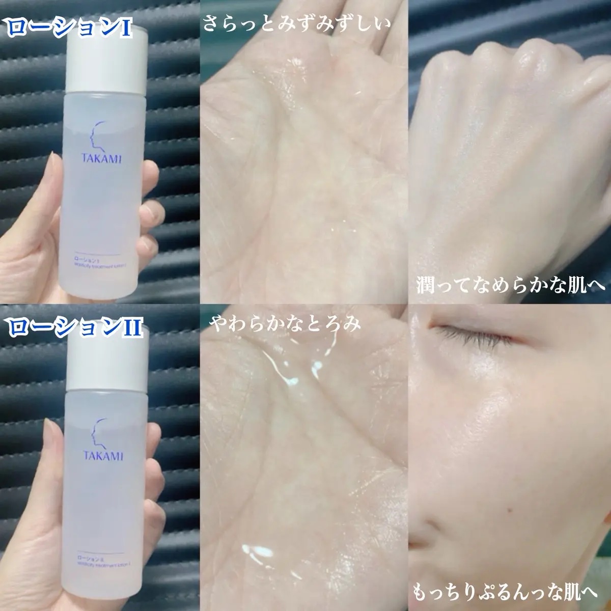 タカミスキンピール/タカミ/ブースター・導入液を使ったクチコミ（3枚目）