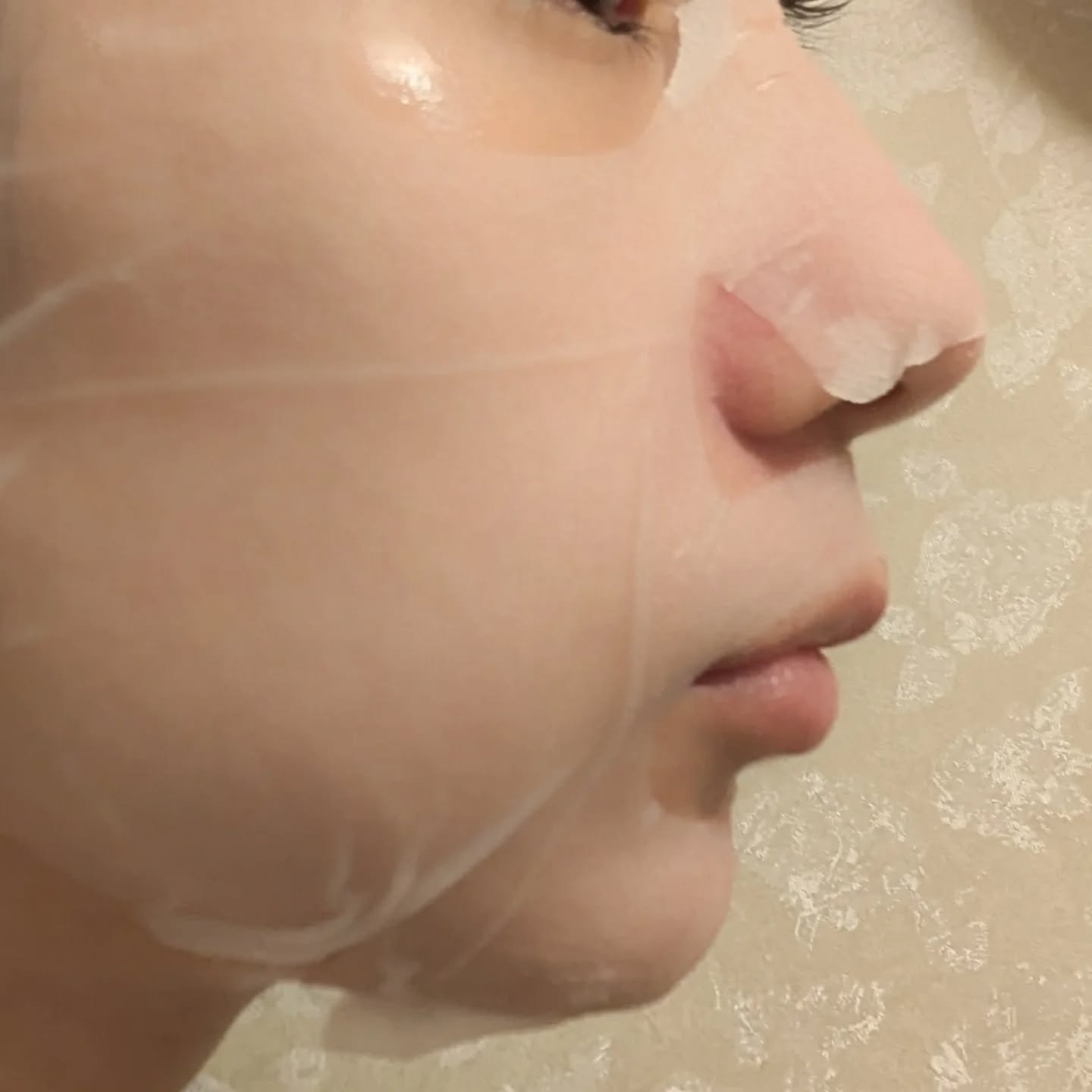 リズム ピコレーザー ニードルスポットパック/RISM/シートマスク・パックを使ったクチコミ（3枚目）