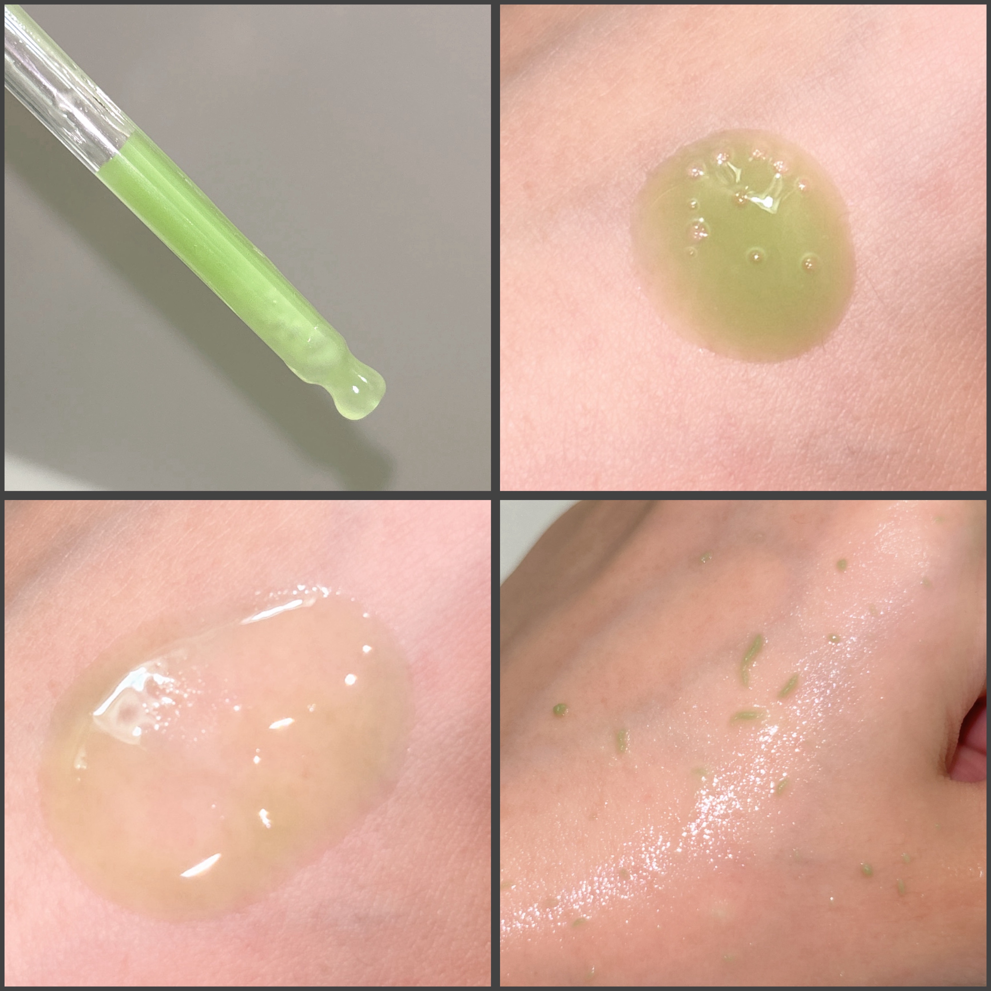 アゼライン酸ゴマージュピーリングセラム/Dr.Melaxin/美容液を使ったクチコミ（3枚目）