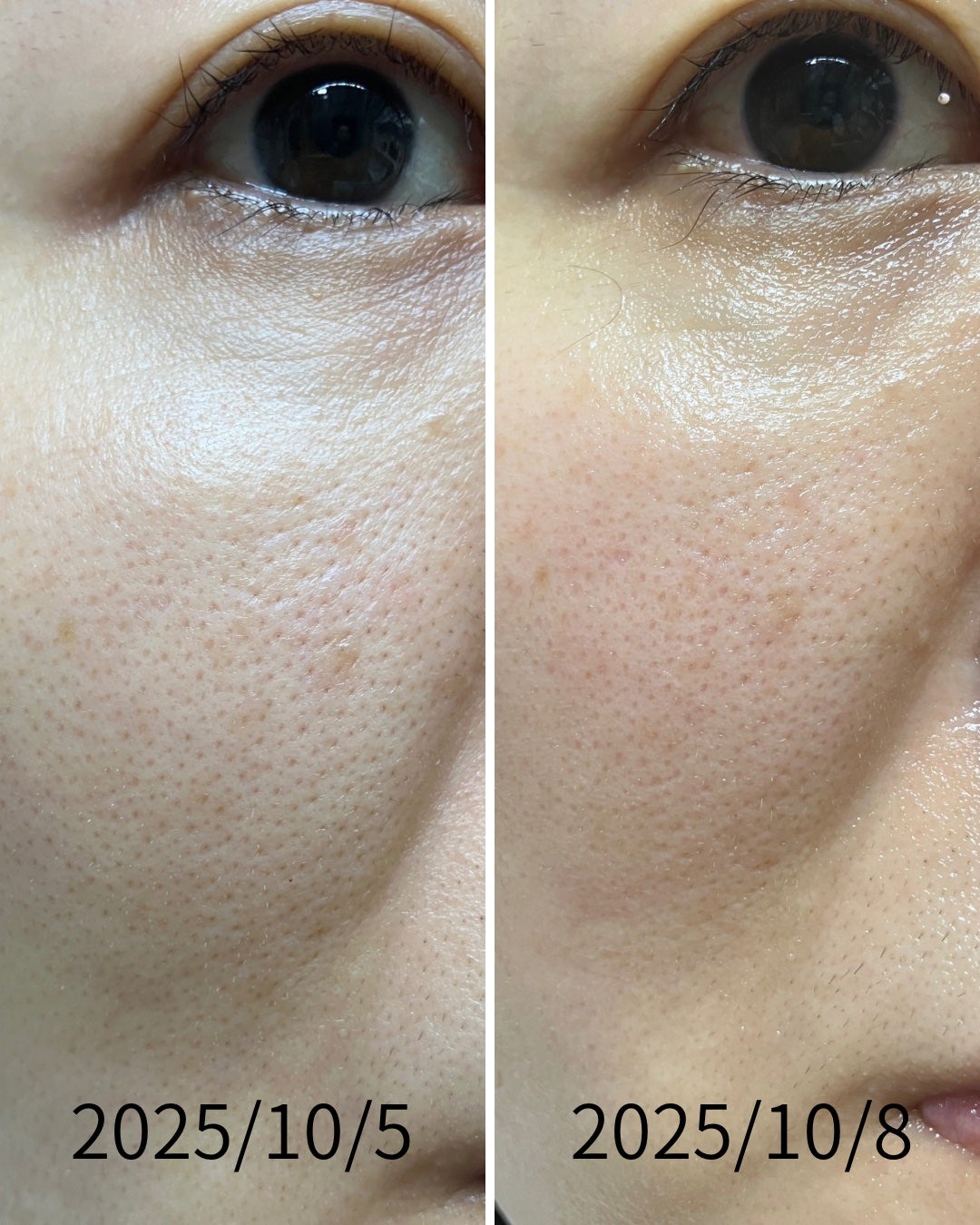 プロバイオシカ インテンシブ アンプル/SKIN1004/美容液を使ったクチコミ(1枚目)