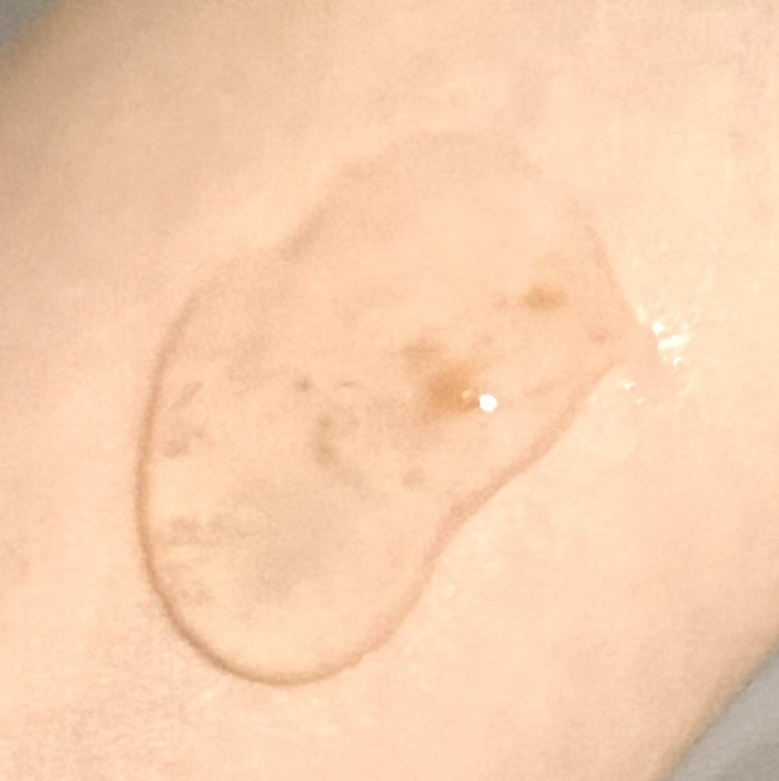 マデカバイタルカプセルセラム/センテリアン24/美容液を使ったクチコミ（2枚目）