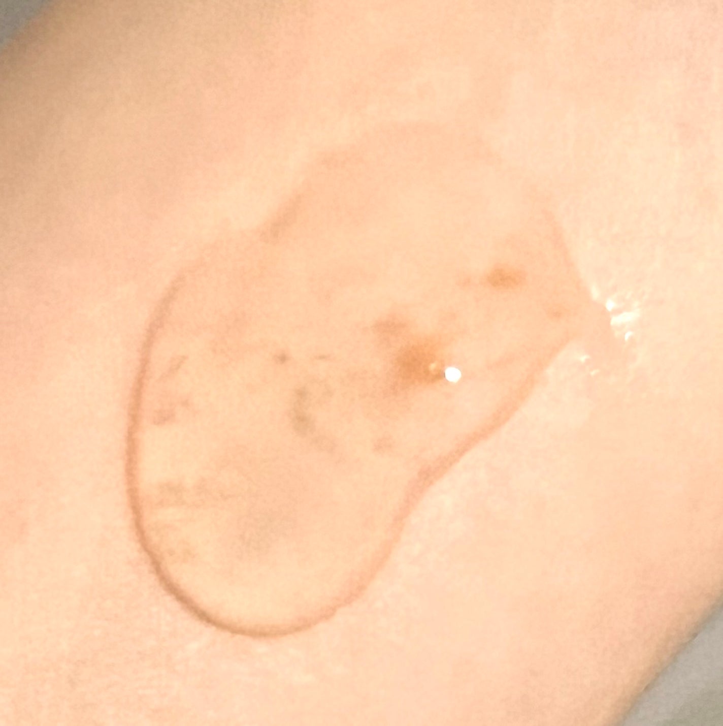 マデカバイタルカプセルセラム/センテリアン24/美容液を使ったクチコミ(2枚目)