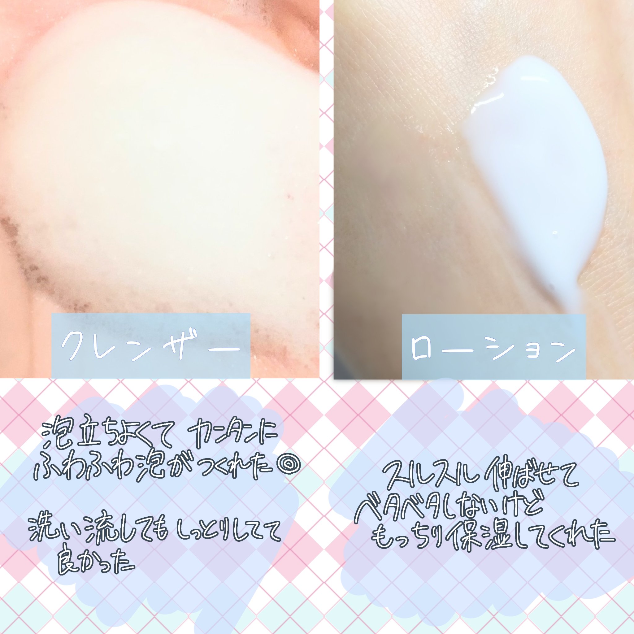 セタフィル　ジェントルSAローション/セタフィル/ピーリングを使ったクチコミ（2枚目）