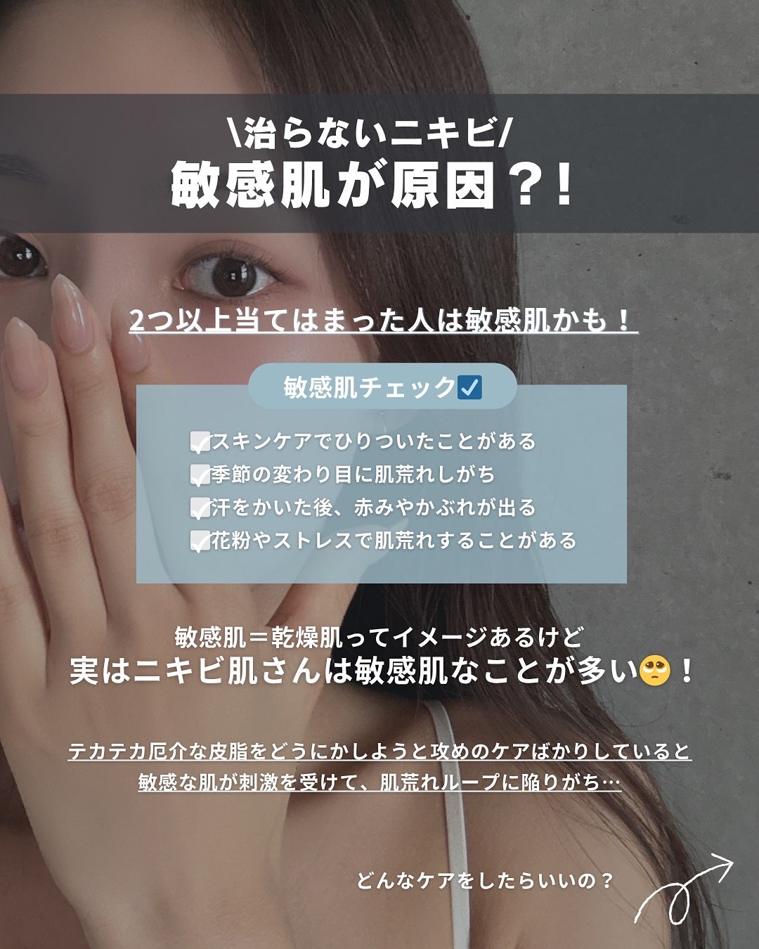 白湯(サユ) | ニキビと戦うOL🤍 on LIPS 「・白湯です🫶🏻今回は意外と多い「敏感肌ニキビ」について徹底解説..」(2枚目)