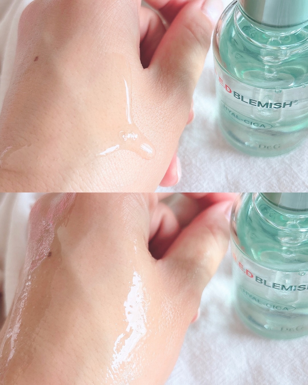 レッドブレミッシュ クリアスージングクリーム/Dr.G/フェイスクリームを使ったクチコミ（3枚目）