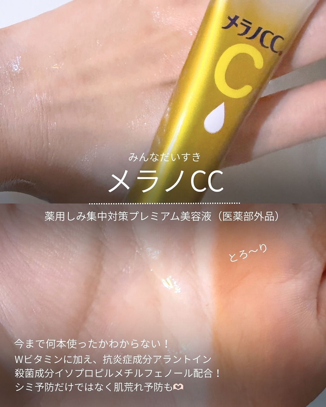オバジC クリアアドバンスドローション 150mL/オバジ/化粧水を使ったクチコミ（3枚目）