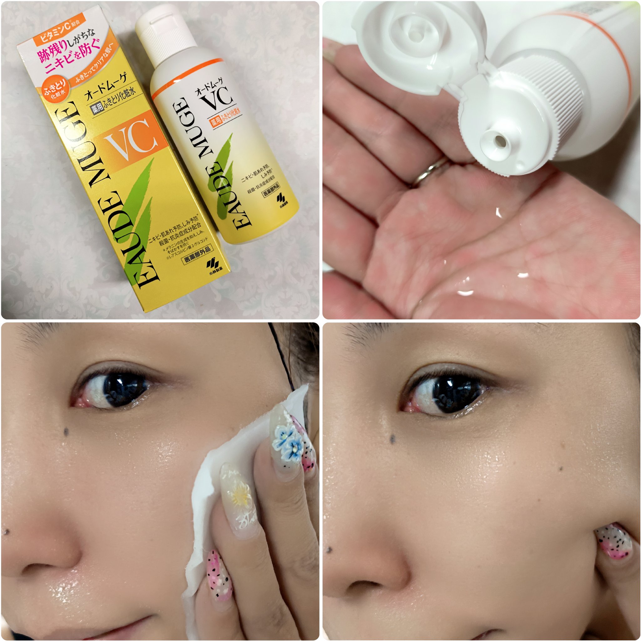 オードムーゲVC 薬用ふきとり化粧水/オードムーゲ/拭き取り化粧水を使ったクチコミ（3枚目）