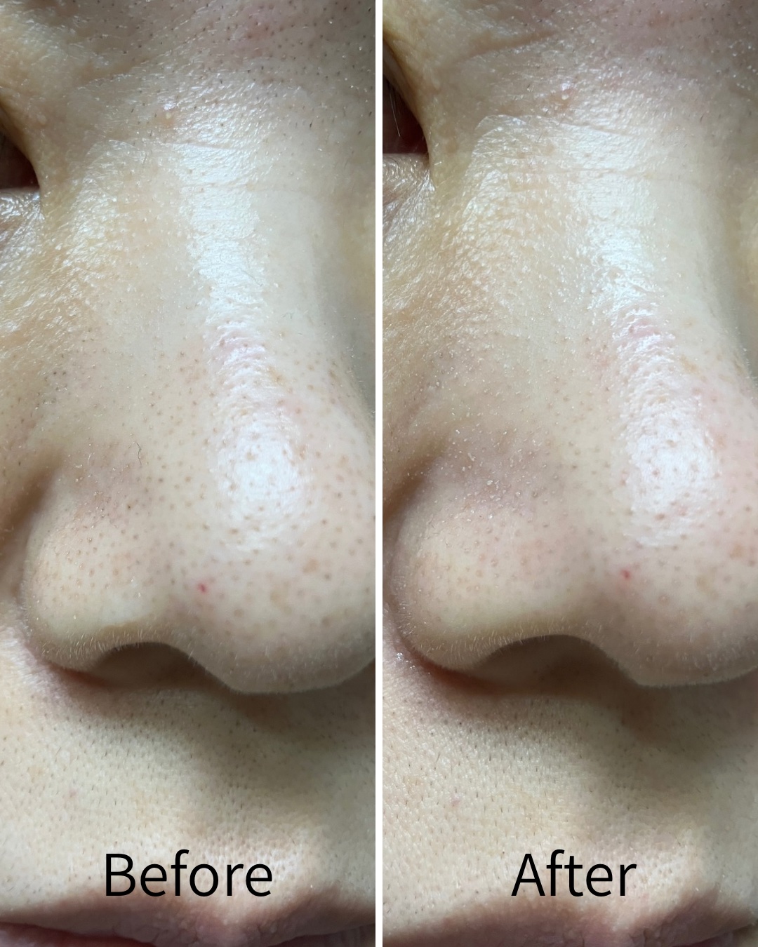 【記録用】
39歳、肌年齢＋7歳。問題だらけの肌をどうにかしたい会、発足しました（会員1名）。

はい。毛穴には「酵素洗顔がいいよ」とチャッピーが言ってたので、巷で人気のアイテムに手を出してみたわけです。

説明書に「泡立てて肌に満遍なくの