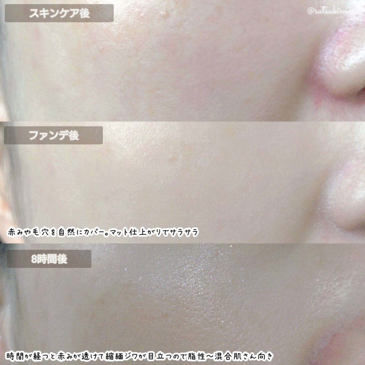 エアリーポアカバークッション/AMUSE/クッションファンデーションを使ったクチコミ(5枚目)