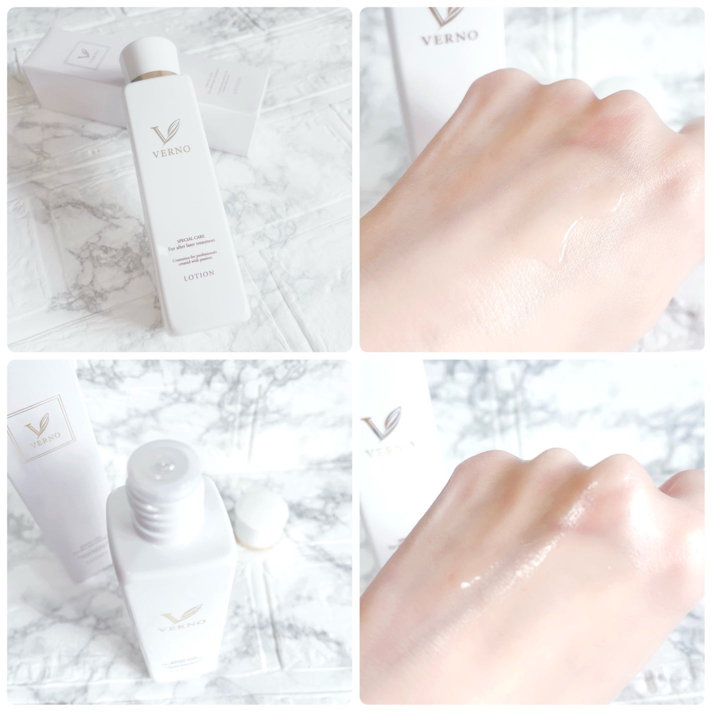 VERNO SKIN ローション〈医薬部外品〉/VERNO SKIN CARE/化粧水を使ったクチコミ(2枚目)