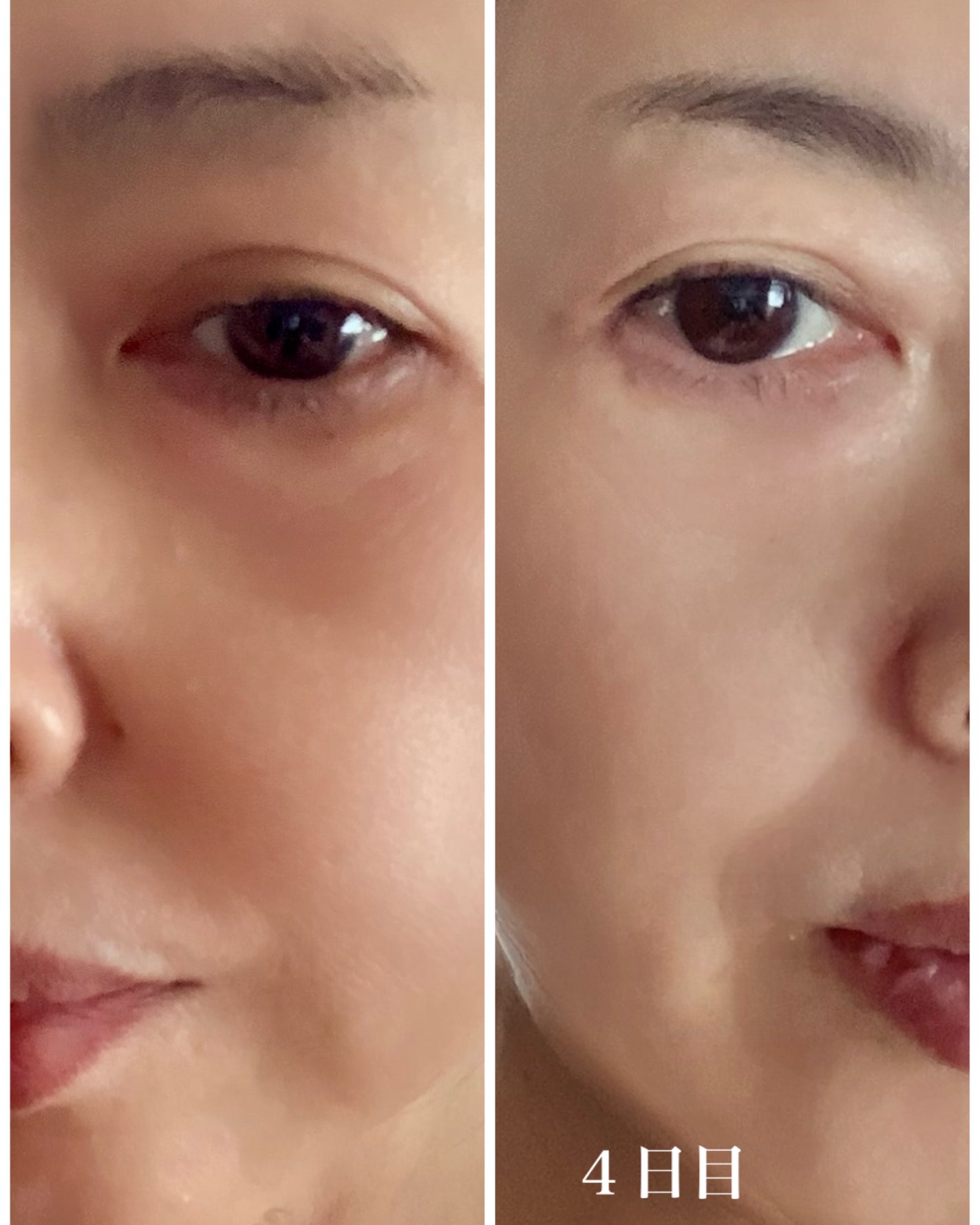 レトックスライン/Balance Flow/ボディサプリメントを使ったクチコミ(4枚目)