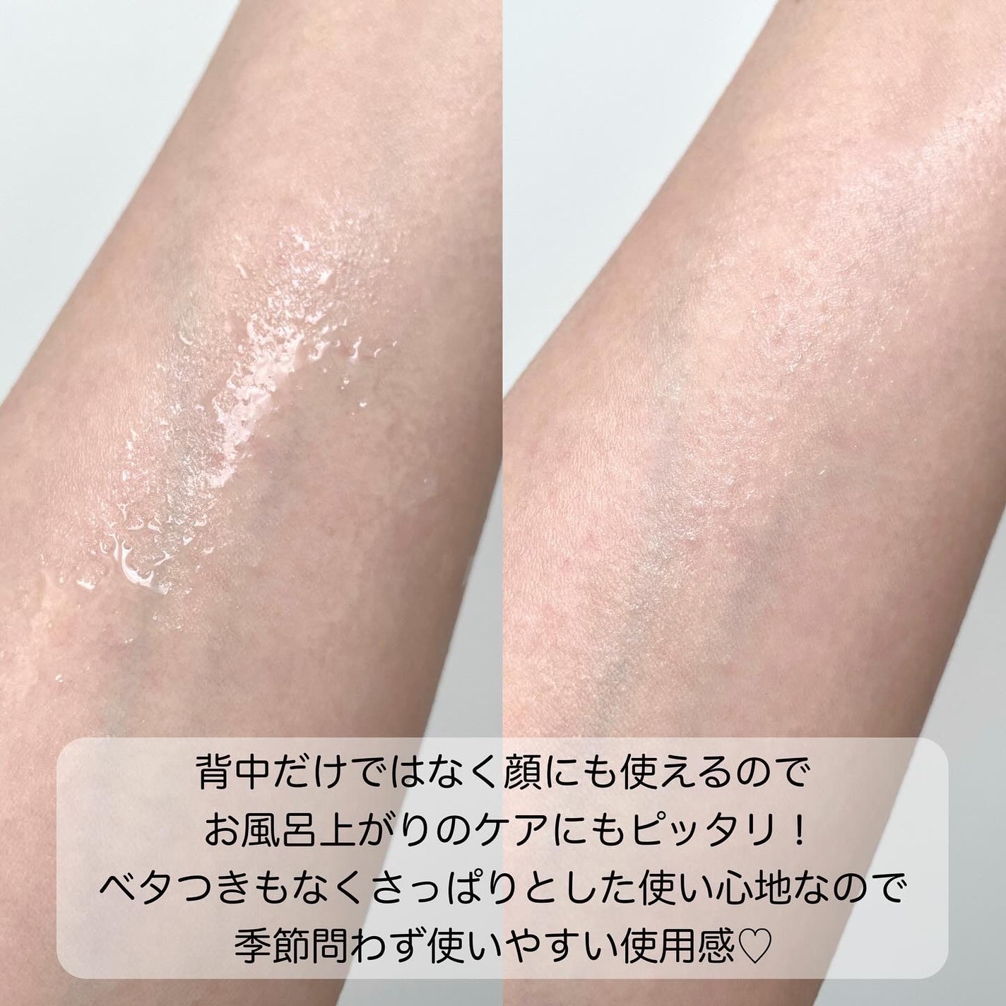 背中ニキ美 化粧水/エトワラン/ボディローションを使ったクチコミ(3枚目)