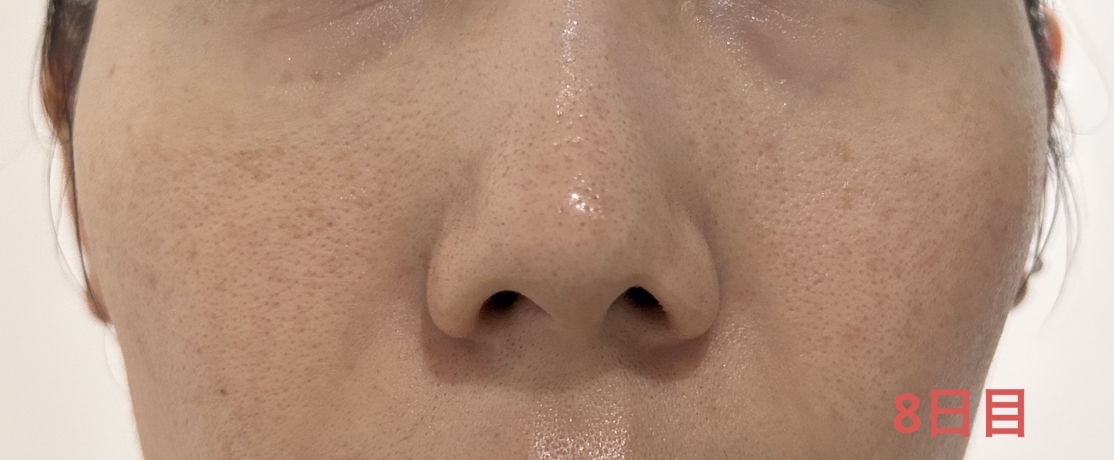 ボタニカルピール ピーリングパウダー Lv7/BOTANICAL PEEL/ピーリングを使ったクチコミ（2枚目）