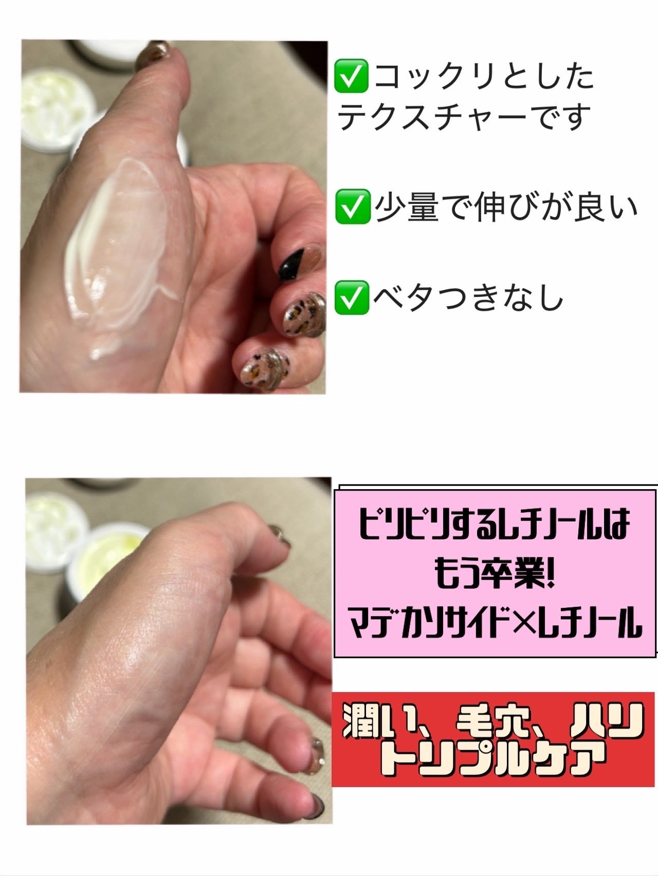 まゆ on LIPS 「Lepiqueレピク様よりレピク レチノールナイトクリーム50..」(3枚目)