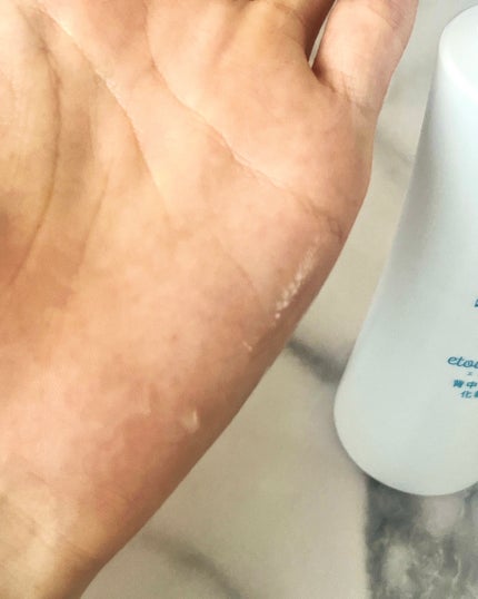 背中ニキ美クリーム/エトワラン/ボディクリームを使ったクチコミ(2枚目)