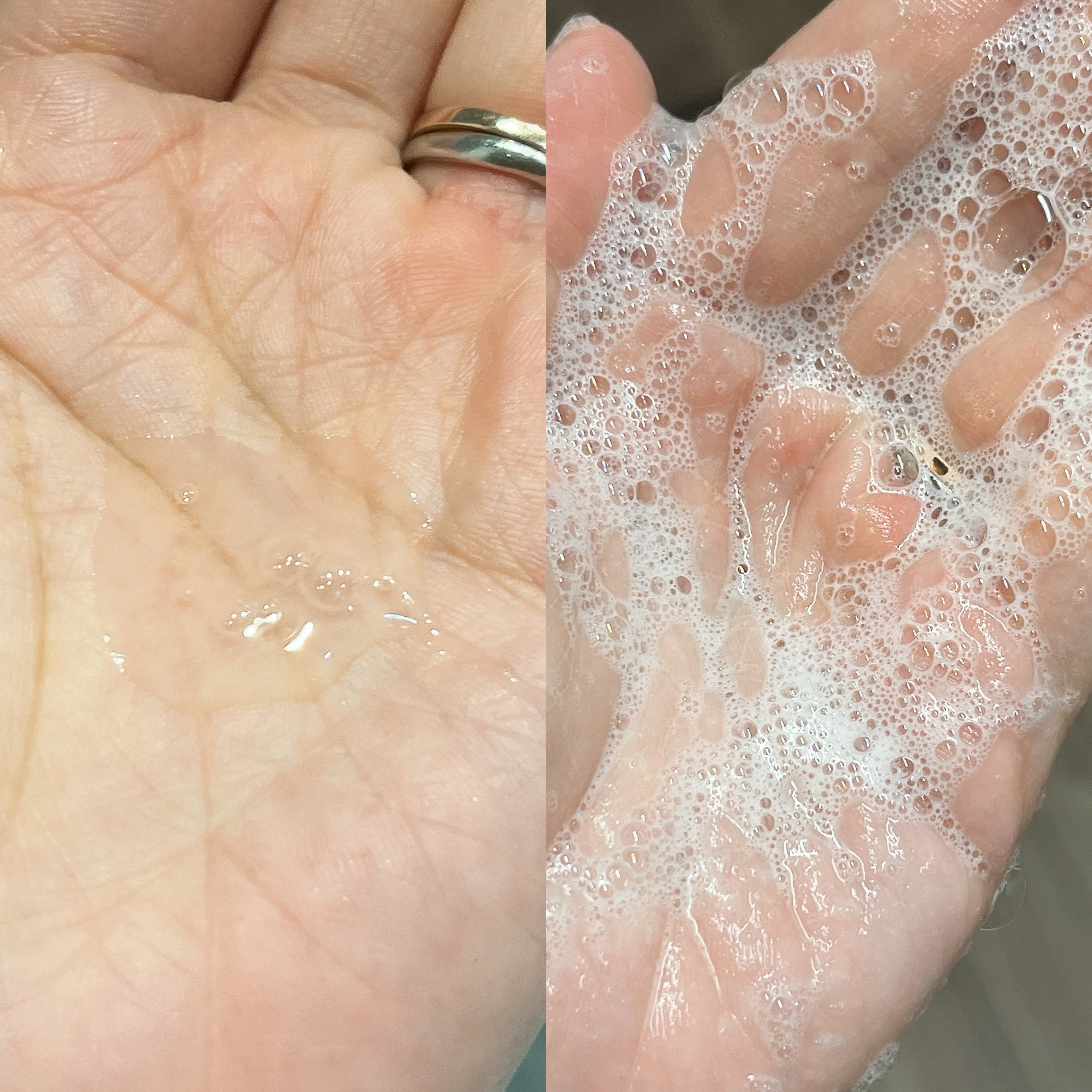 セタフィル　ジェントルSAクレンザー/セタフィル/ピーリングを使ったクチコミ（3枚目）