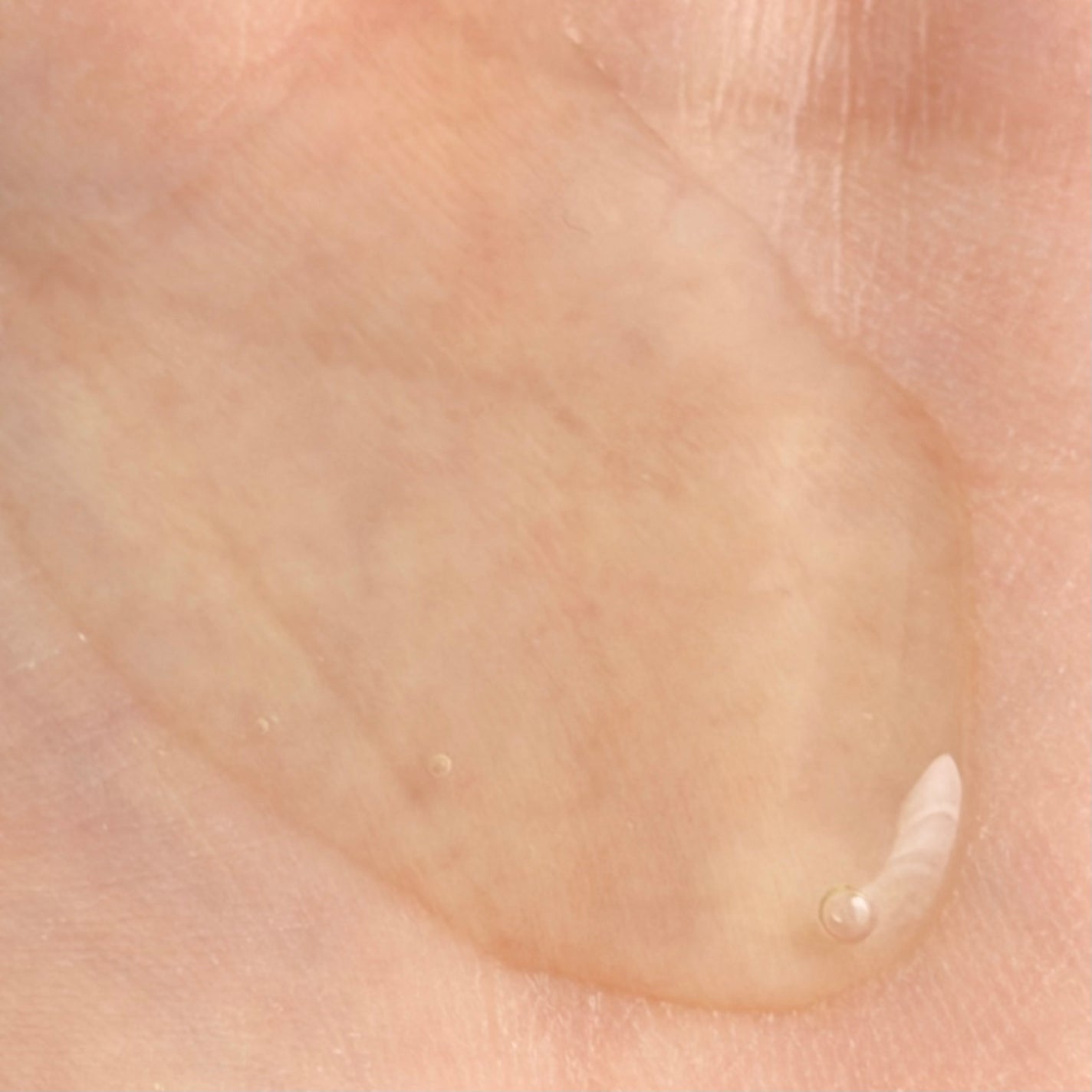 スカルプ ターンシャンプー/リリーイブ/市販シャンプーを使ったクチコミ(3枚目)