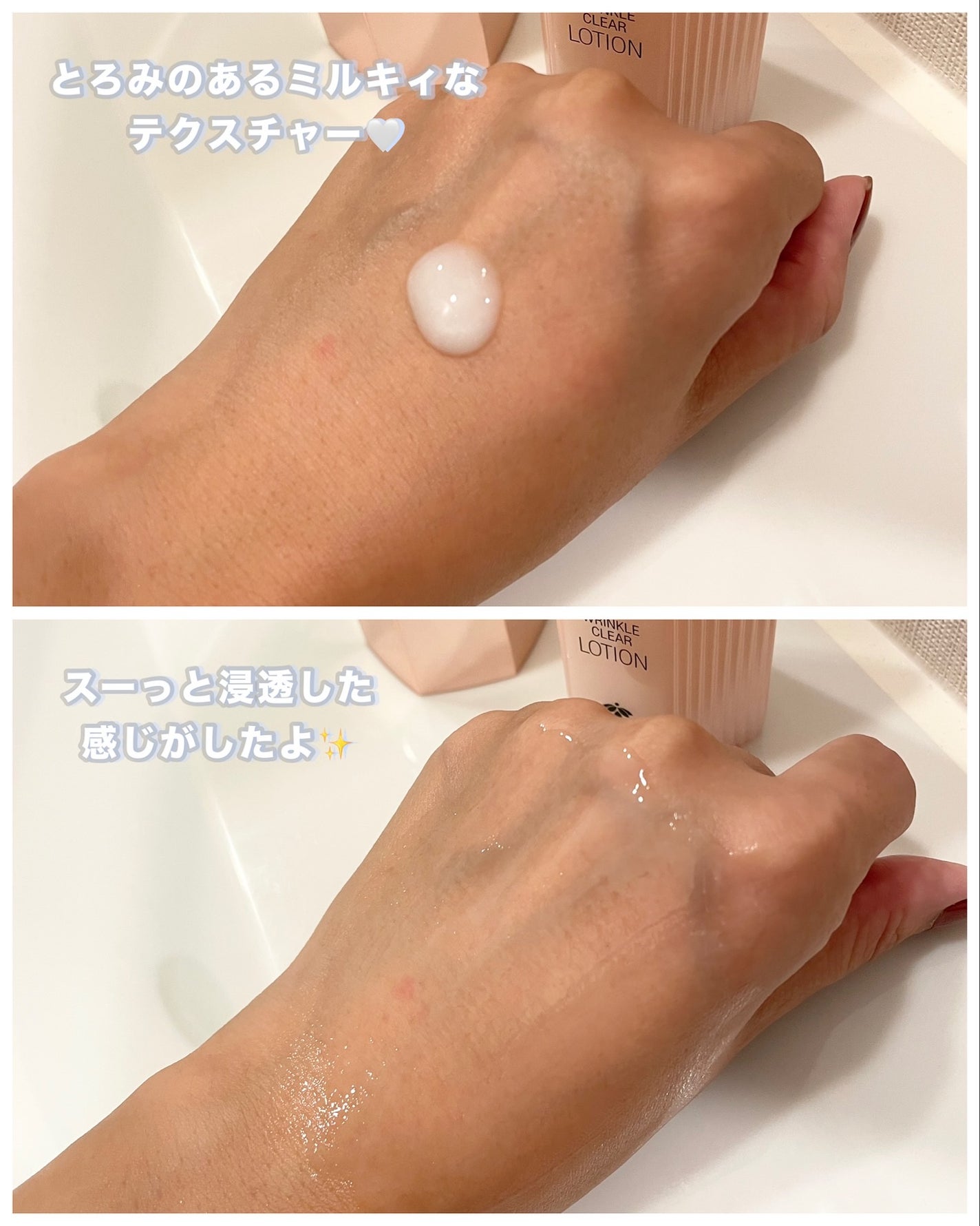 RJ エクセレント 薬用リンクルクリアローション/アピセラピーコスメティクス/化粧水を使ったクチコミ(4枚目)