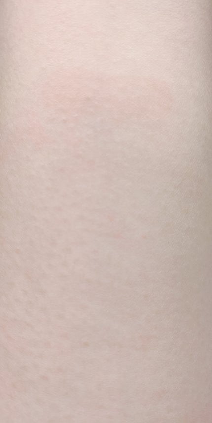 ダヴ すっきり毛穴ケアクレンジングバーム/ダヴ/クレンジングバームを使ったクチコミ(5枚目)