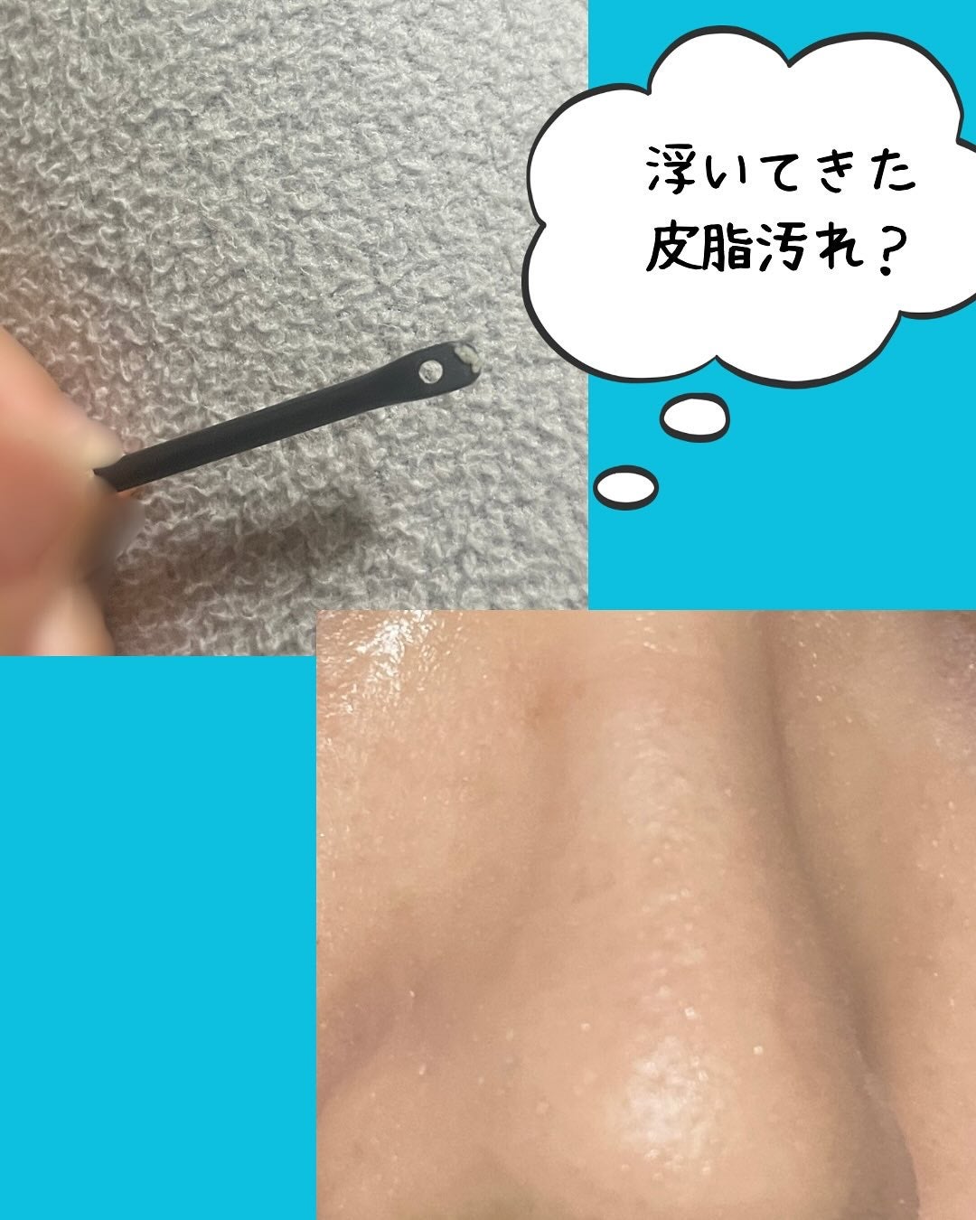 ナチュラルマイルドクリアノーズパック/ilso/シートマスク・パックを使ったクチコミ(4枚目)