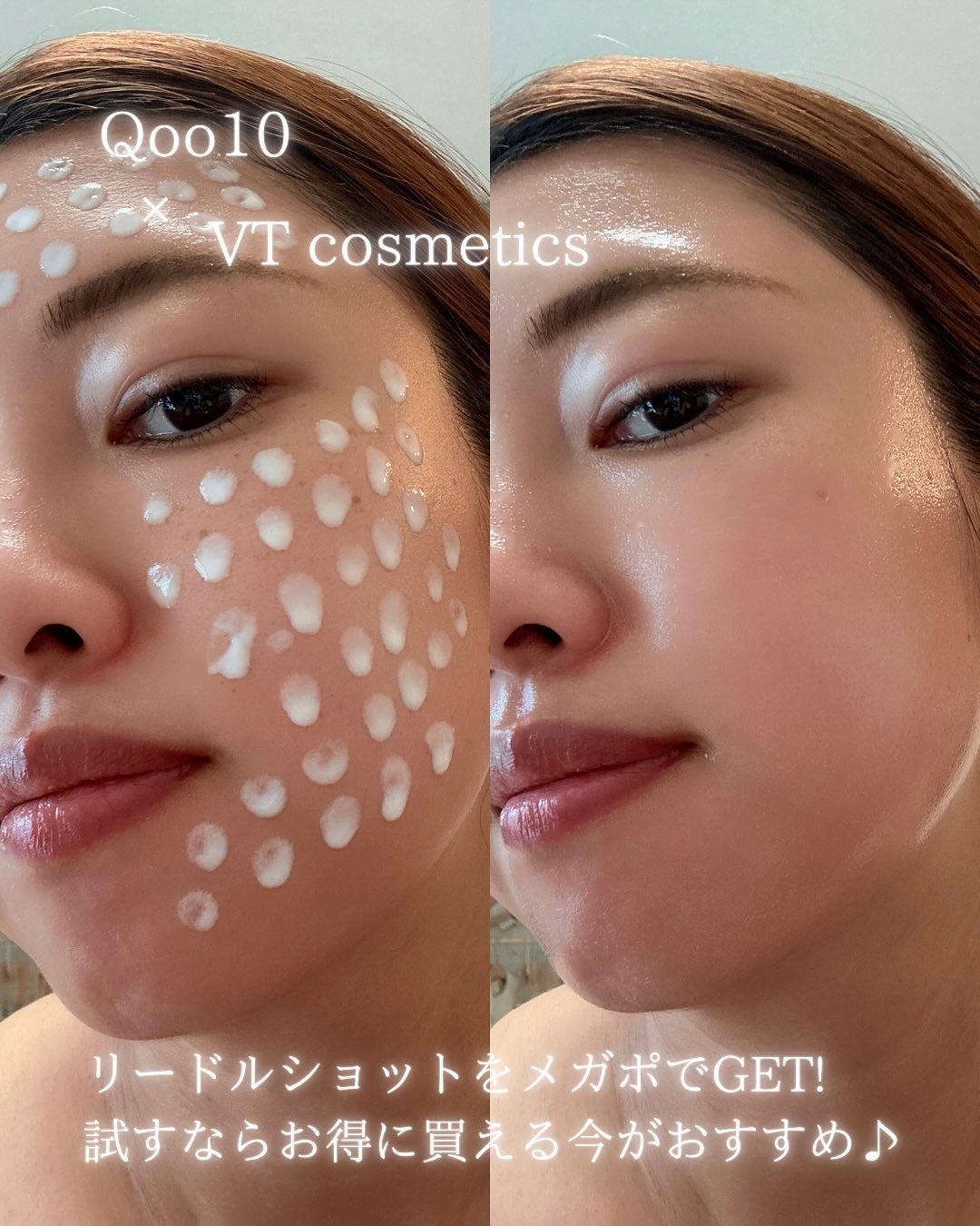 リードルショット100/VT/美容液を使ったクチコミ(10枚目)