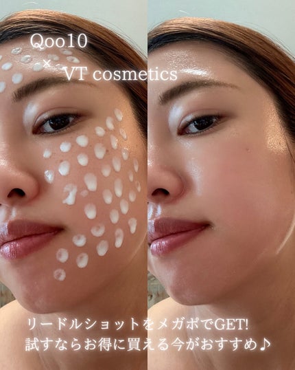 リードルショット100/VT/美容液を使ったクチコミ(10枚目)